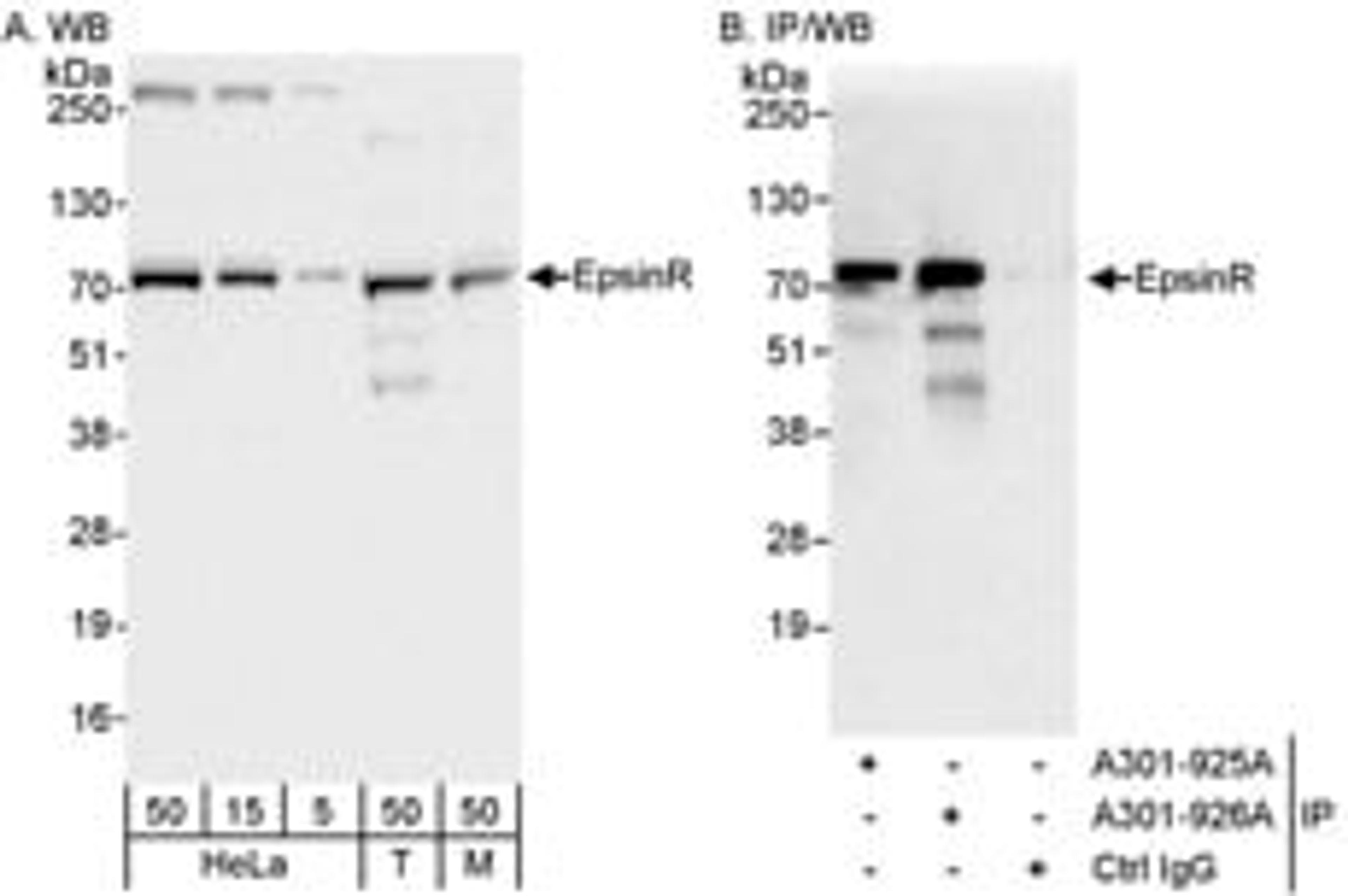 Detection of human and mouse EpsinR by western blot (h&m) and immunoprecipitation (h).