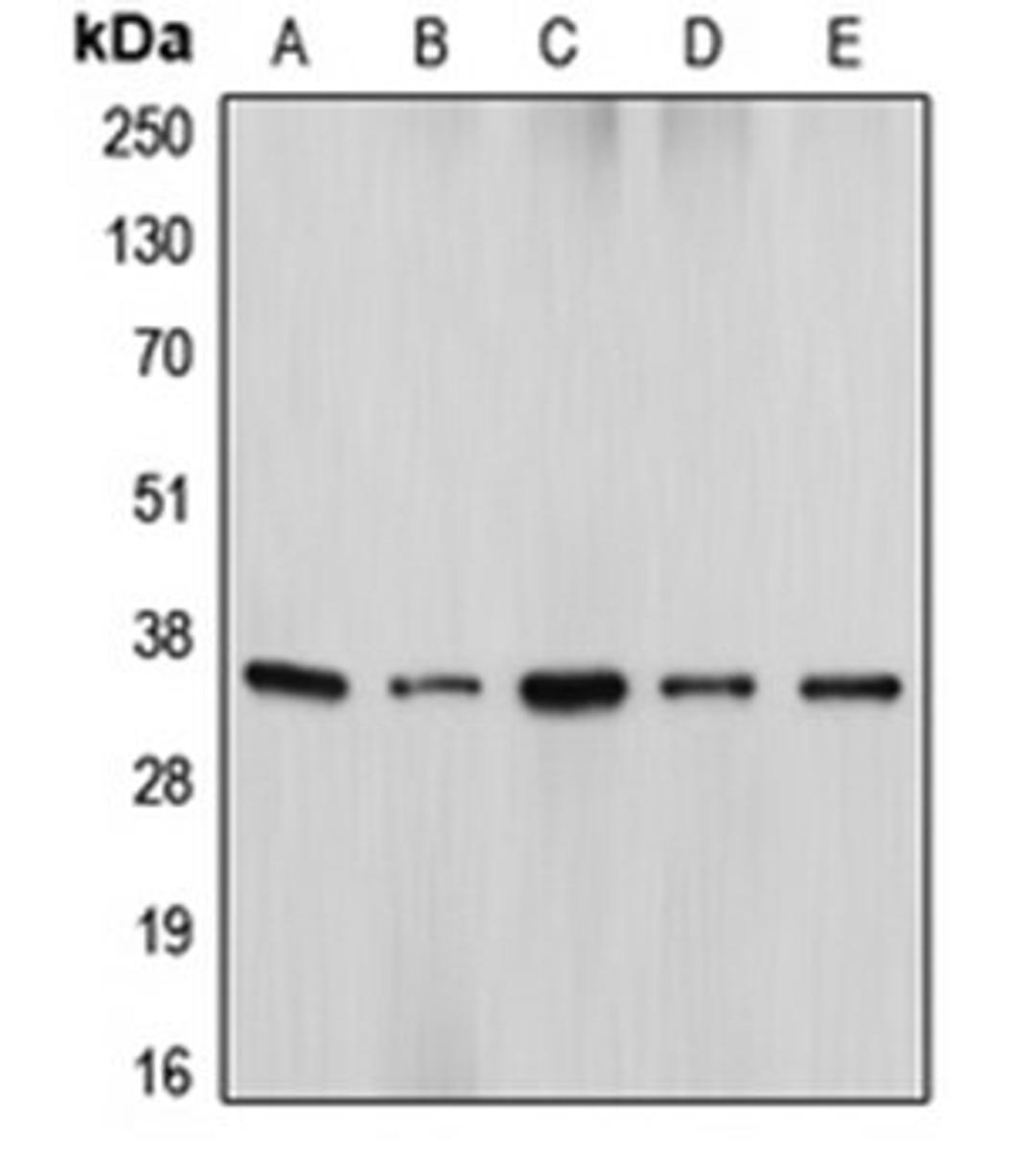 Western blot analysis of HeLa (Lane 1), U937 (Lane 2), WR19L (Lane 3), HEK293T (Lane 4), Jurkat (Lane 5) whole cell lysates using DFFA antibody