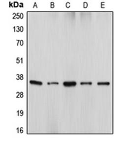 Western blot analysis of HeLa (Lane 1), U937 (Lane 2), WR19L (Lane 3), HEK293T (Lane 4), Jurkat (Lane 5) whole cell lysates using DFFA antibody