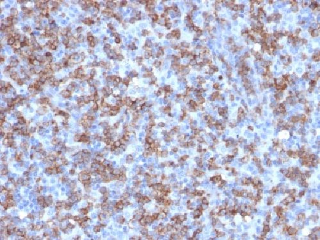 Immunohistochemical staining of CD8A antibody