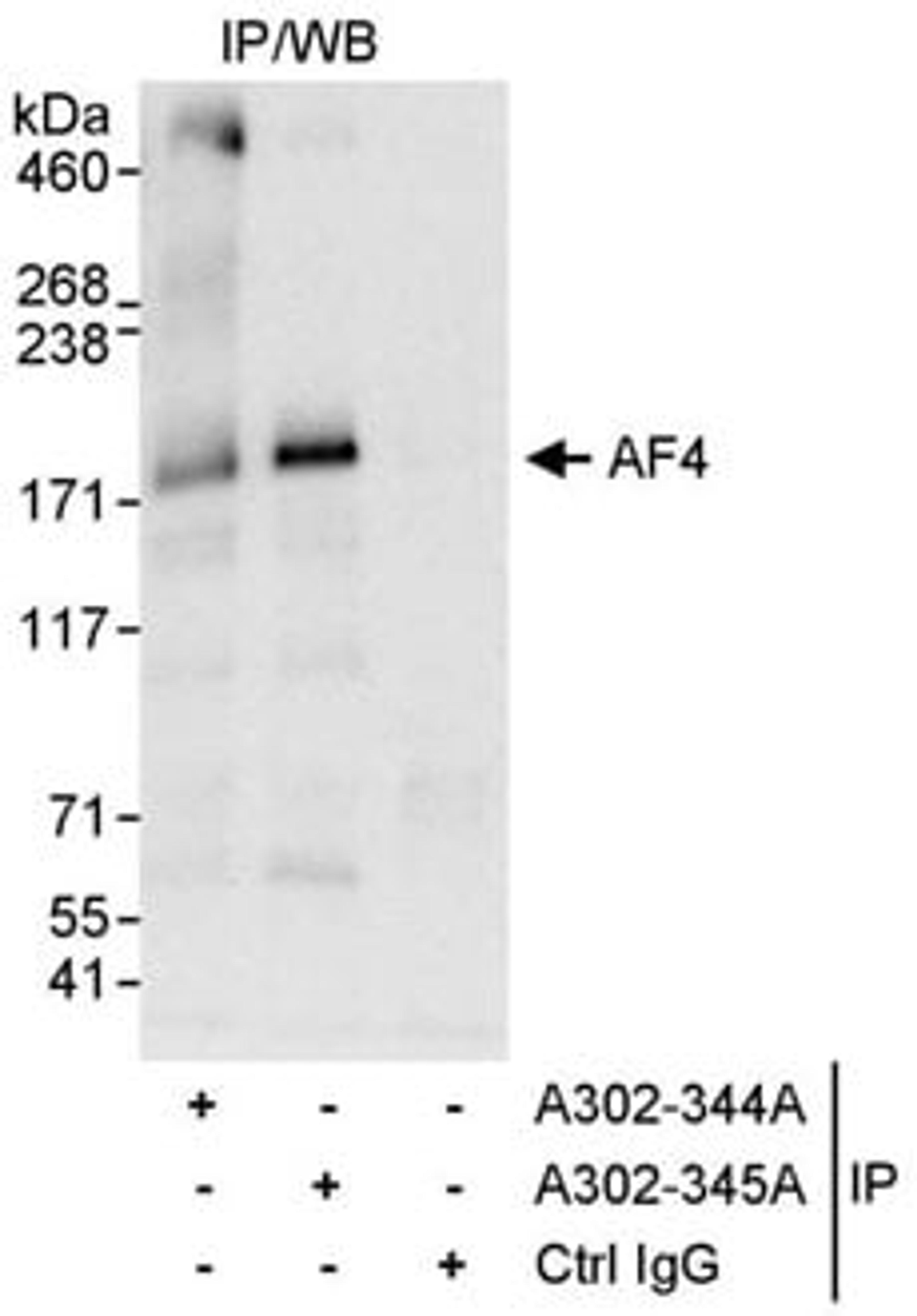 Detection of human AF4 by western blot of immunoprecipitates.