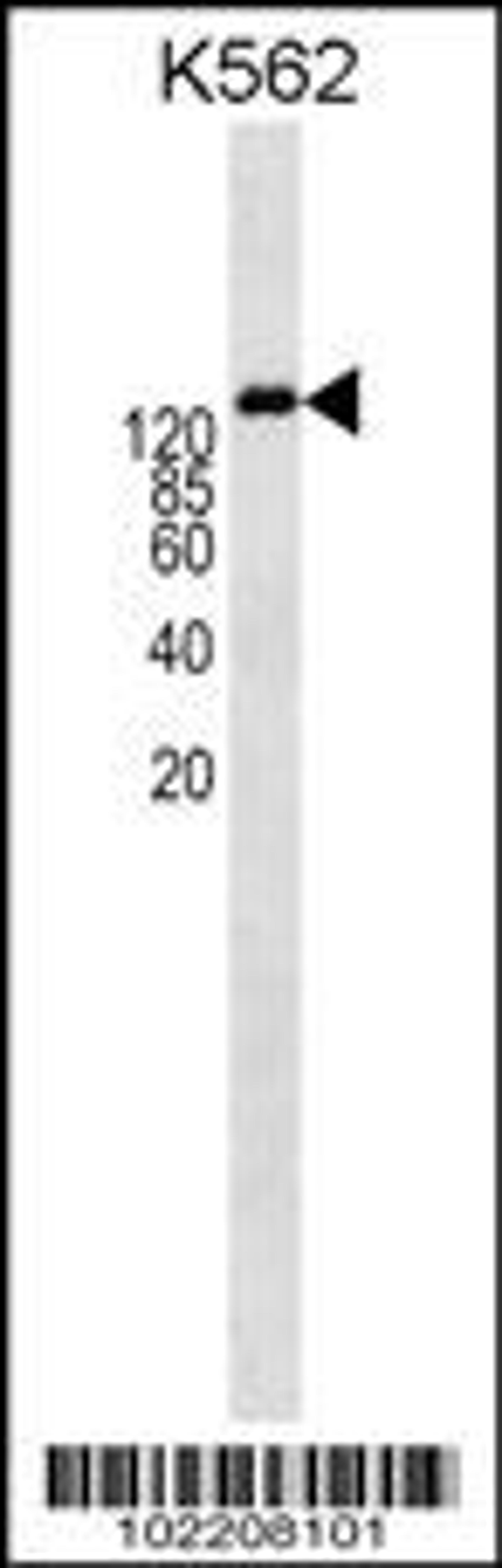 Western blot analysis in K562 cell line lysates (35ug/lane).