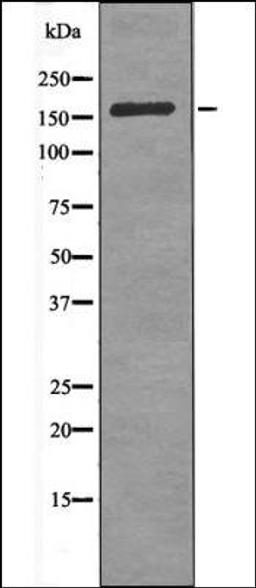 Western blot analysis of Insulin treated HeLa whole cell lysates using CdGAP -Phospho-Thr789- antibody