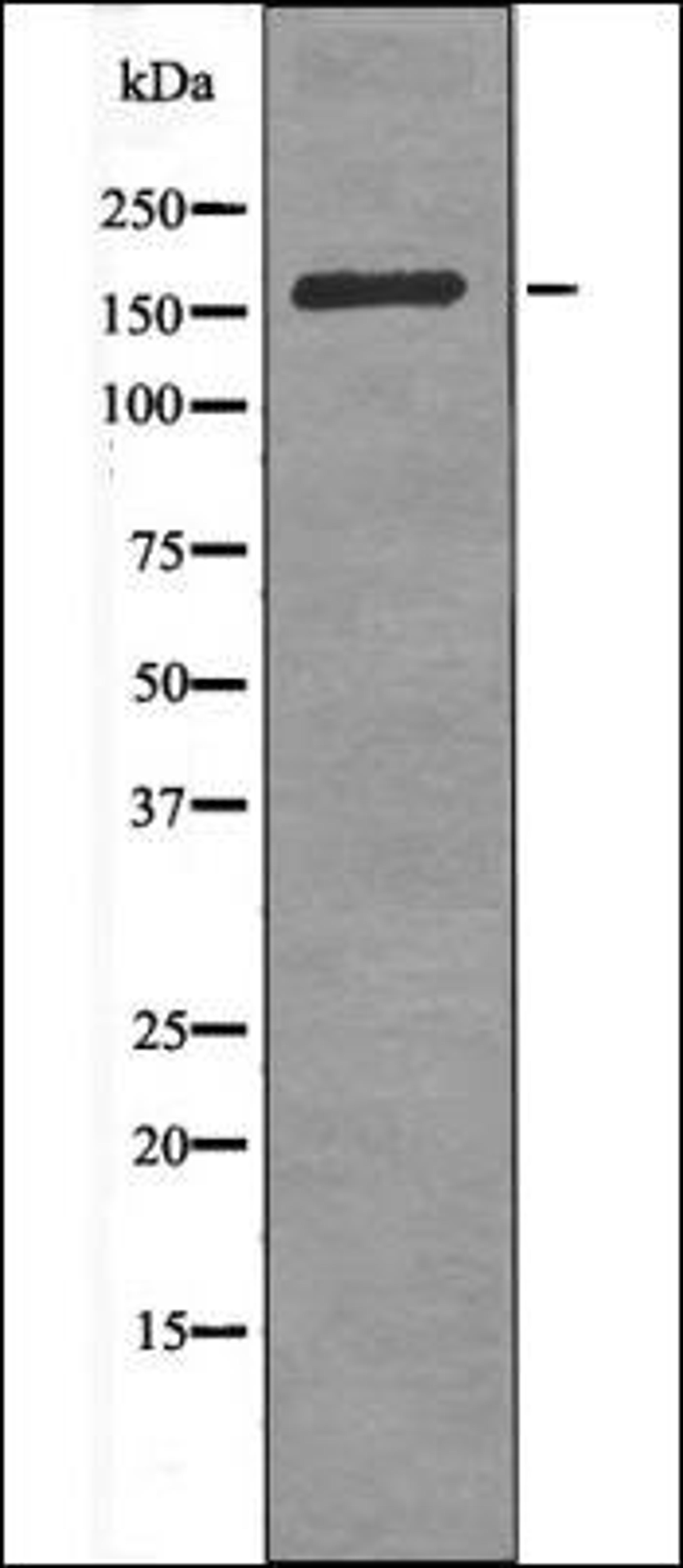 Western blot analysis of Insulin treated HeLa whole cell lysates using CdGAP -Phospho-Thr789- antibody