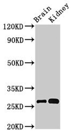 Western Blot. Positive WB detected in: Mouse brain tissue, Mouse kidney tissue. All lanes: OLFML2B antibody at 3µg/ml. Secondary. Goat polyclonal to rabbit IgG at 1/50000 dilution. Predicted band size: 84, 28 kDa. Observed band size: 28 kDa
