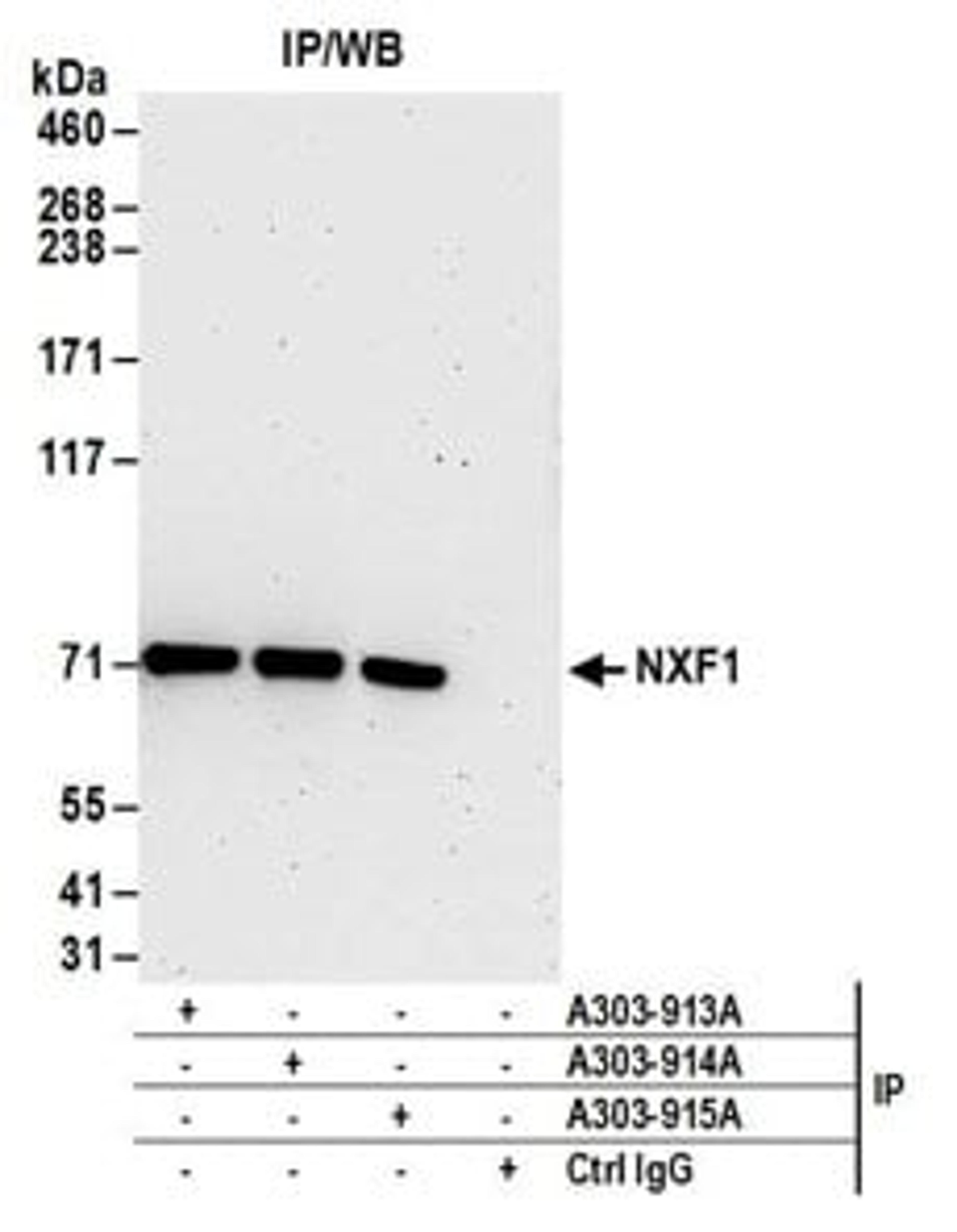 Detection of human NXF1 by western blot of immunoprecipitates.