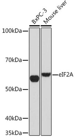 Western blot - eIF2A Rabbit mAb (A9709)