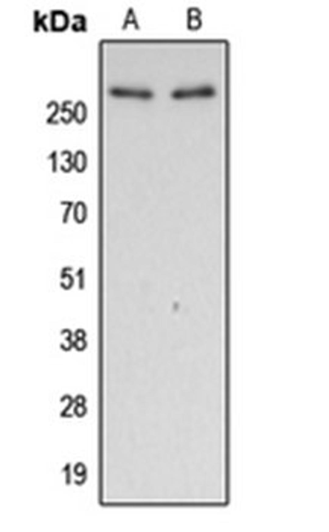 Western blot analysis of HeLa calyculin A-treated (Lane 1), A431 EGF-treated (Lane 2) whole cell lysates using FLNA antibody