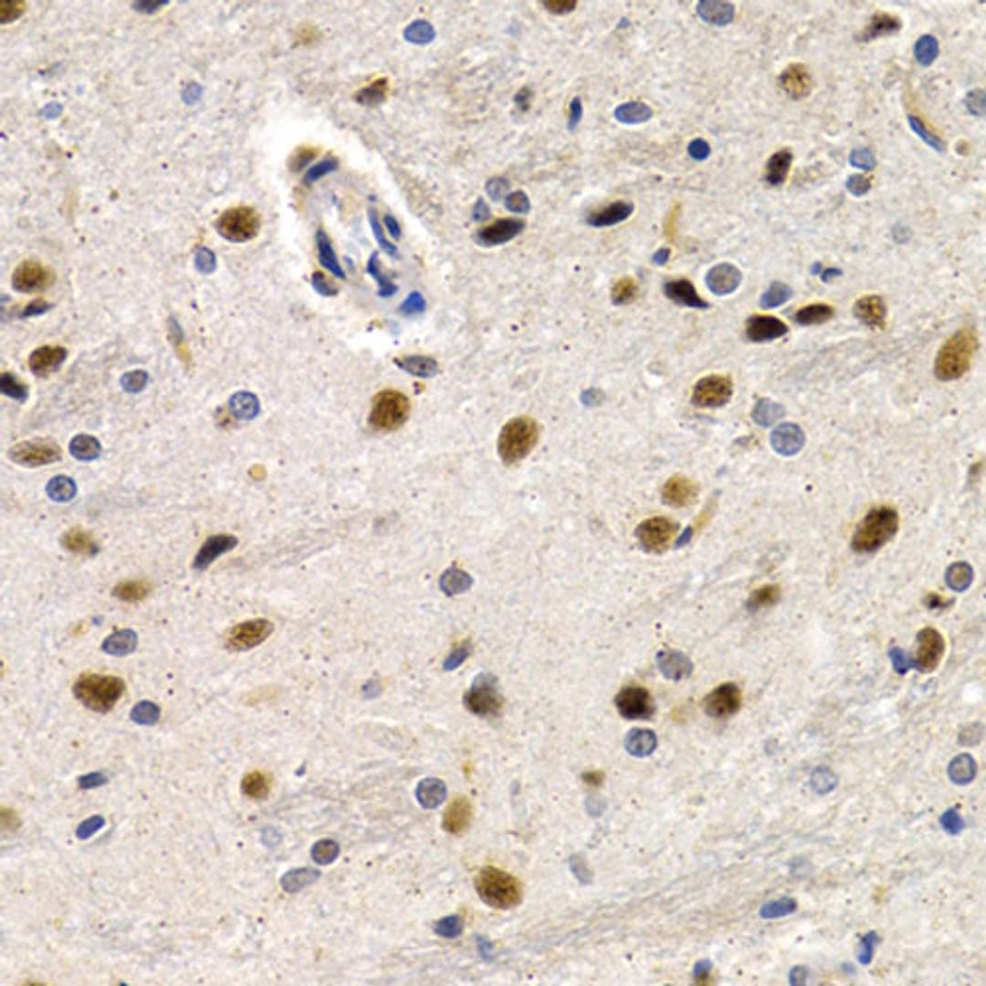 Immunohistochemistry  - ID3 antibody (A5375)