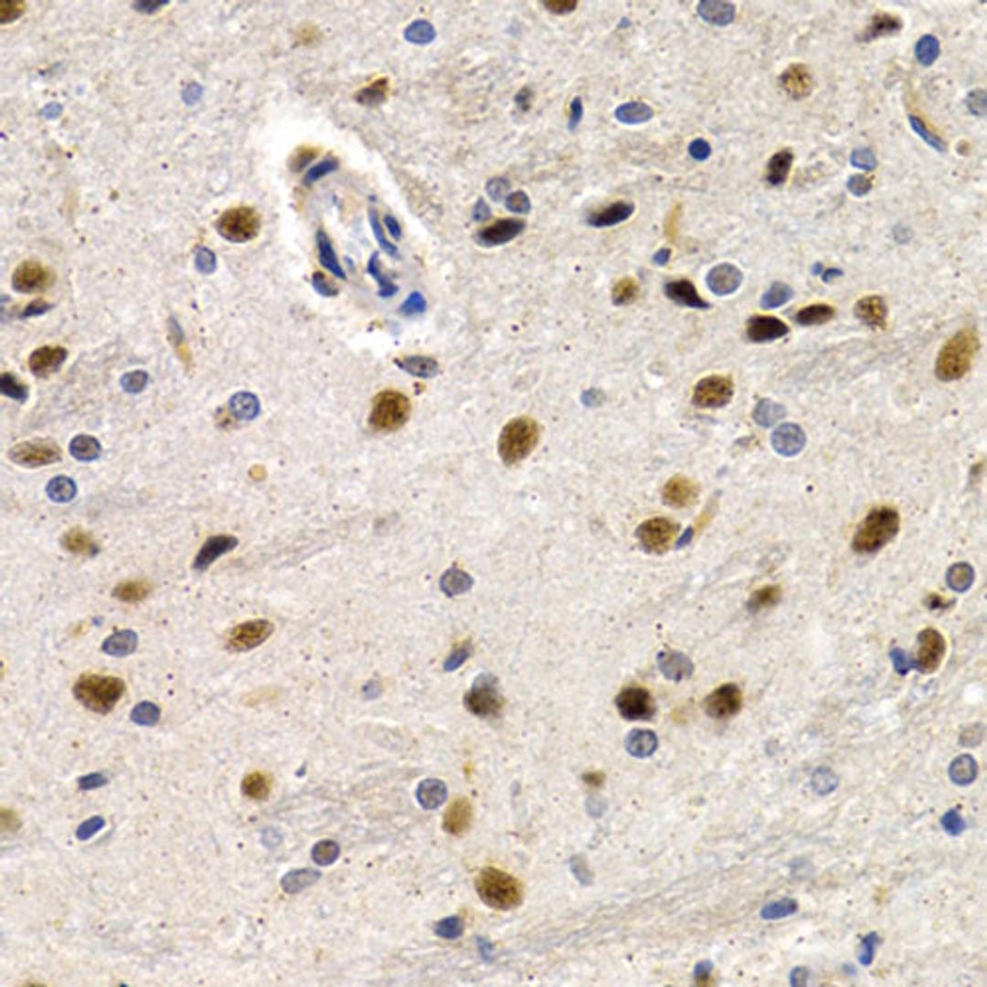 Immunohistochemistry - ID3 antibody (A5375)
