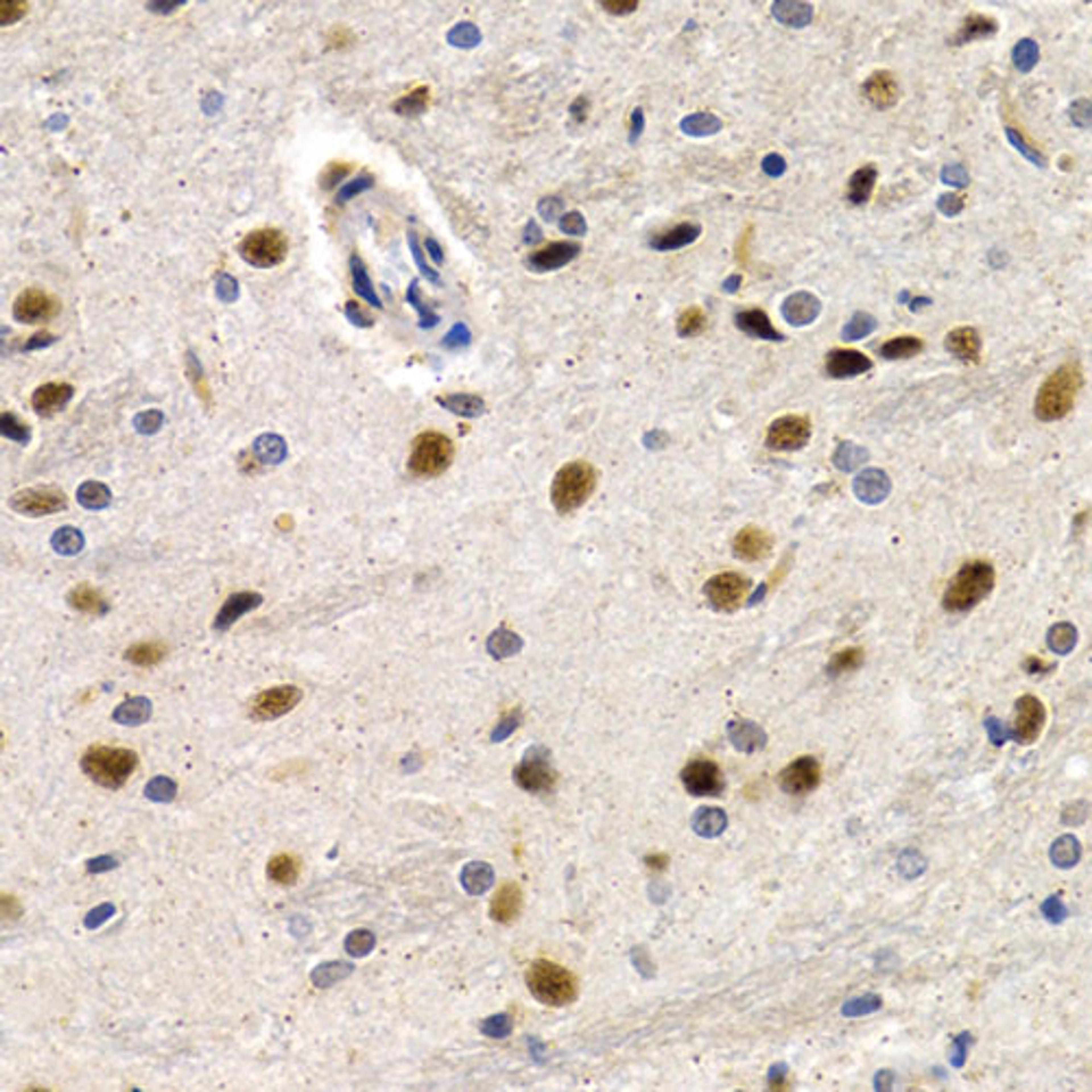 Immunohistochemistry - ID3 antibody (A5375)