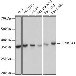 Western blot - CSNK1A1 Rabbit mAb (A9308)