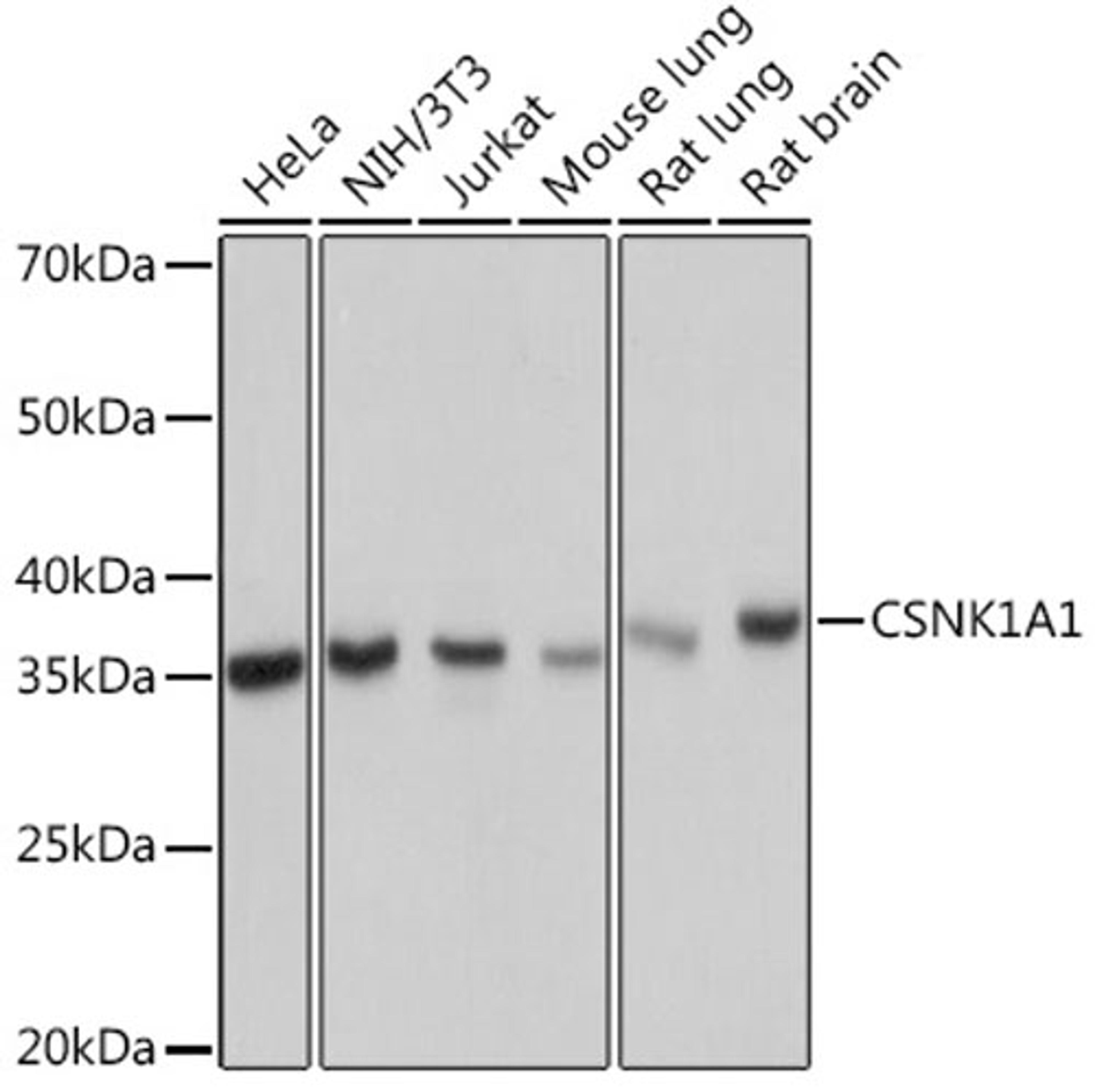 Western blot - CSNK1A1 Rabbit mAb (A9308)