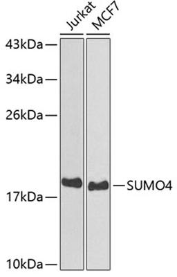 Western blot - SUMO4 antibody (A3100)