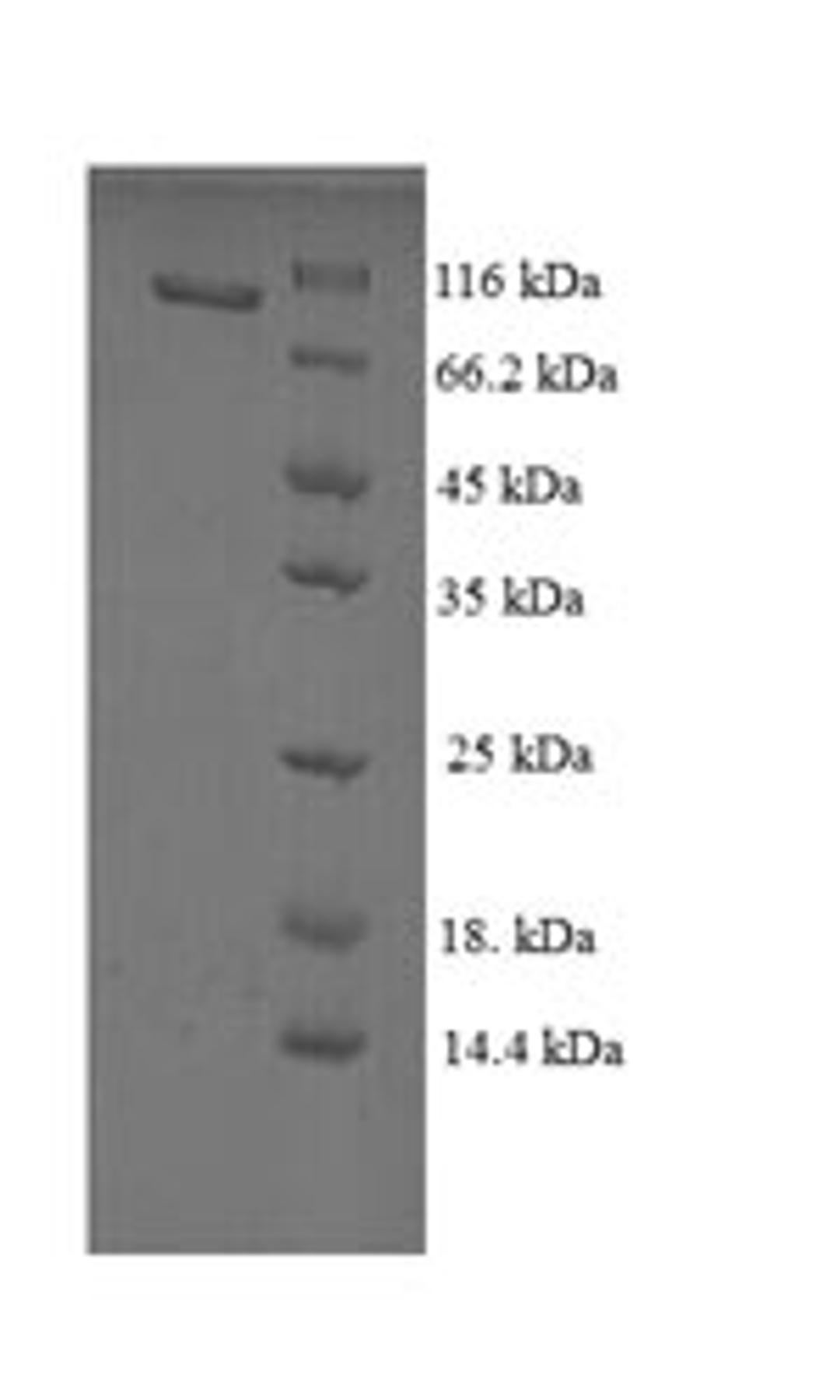 (Tris-Glycine gel) Discontinuous SDS-PAGE (reduced) with 5% enrichment gel and 15% separation gel.