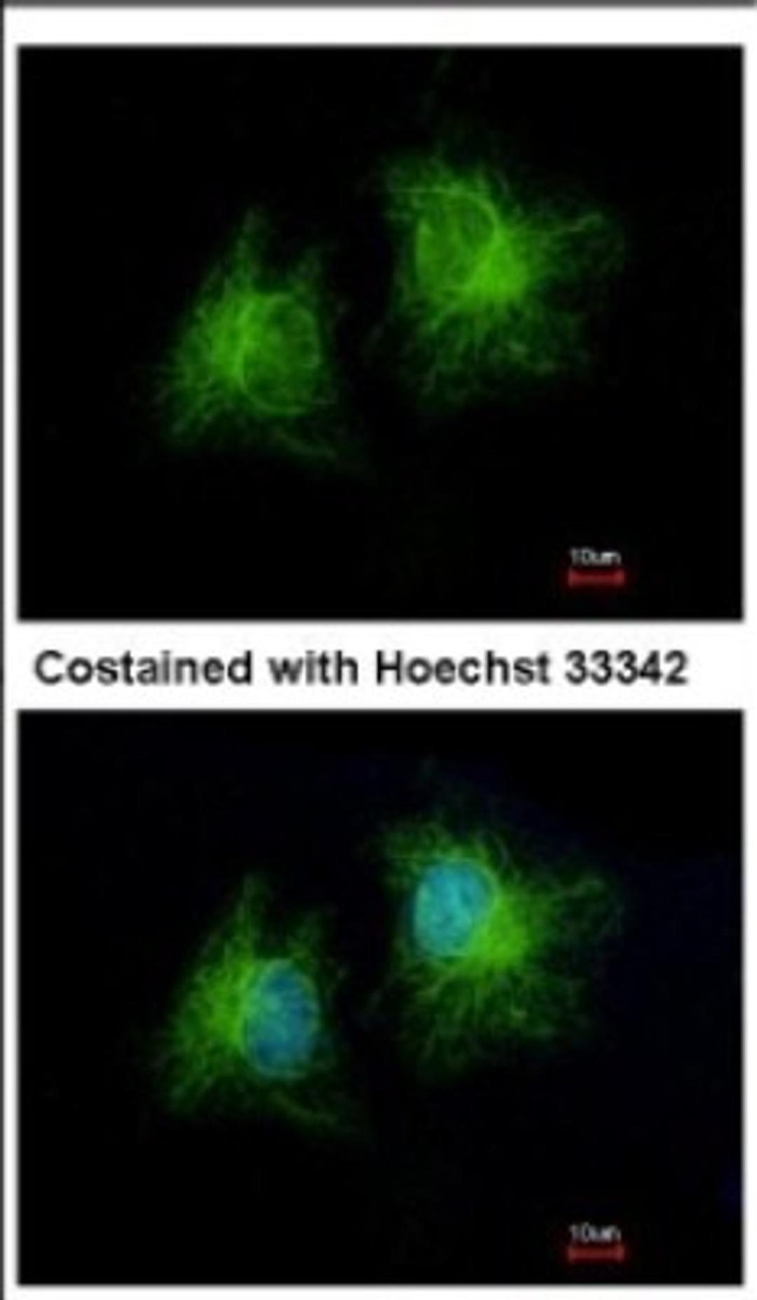 Immunocytochemistry/Immunofluorescence: CCDC28B Antibody [NBP2-15747] - Immunofluorescence analysis of methanol-fixed HeLa, using antibody at 1:500 dilution.