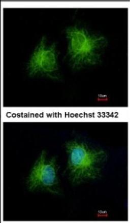 Immunocytochemistry/Immunofluorescence: CCDC28B Antibody [NBP2-15747] - Immunofluorescence analysis of methanol-fixed HeLa, using antibody at 1:500 dilution.