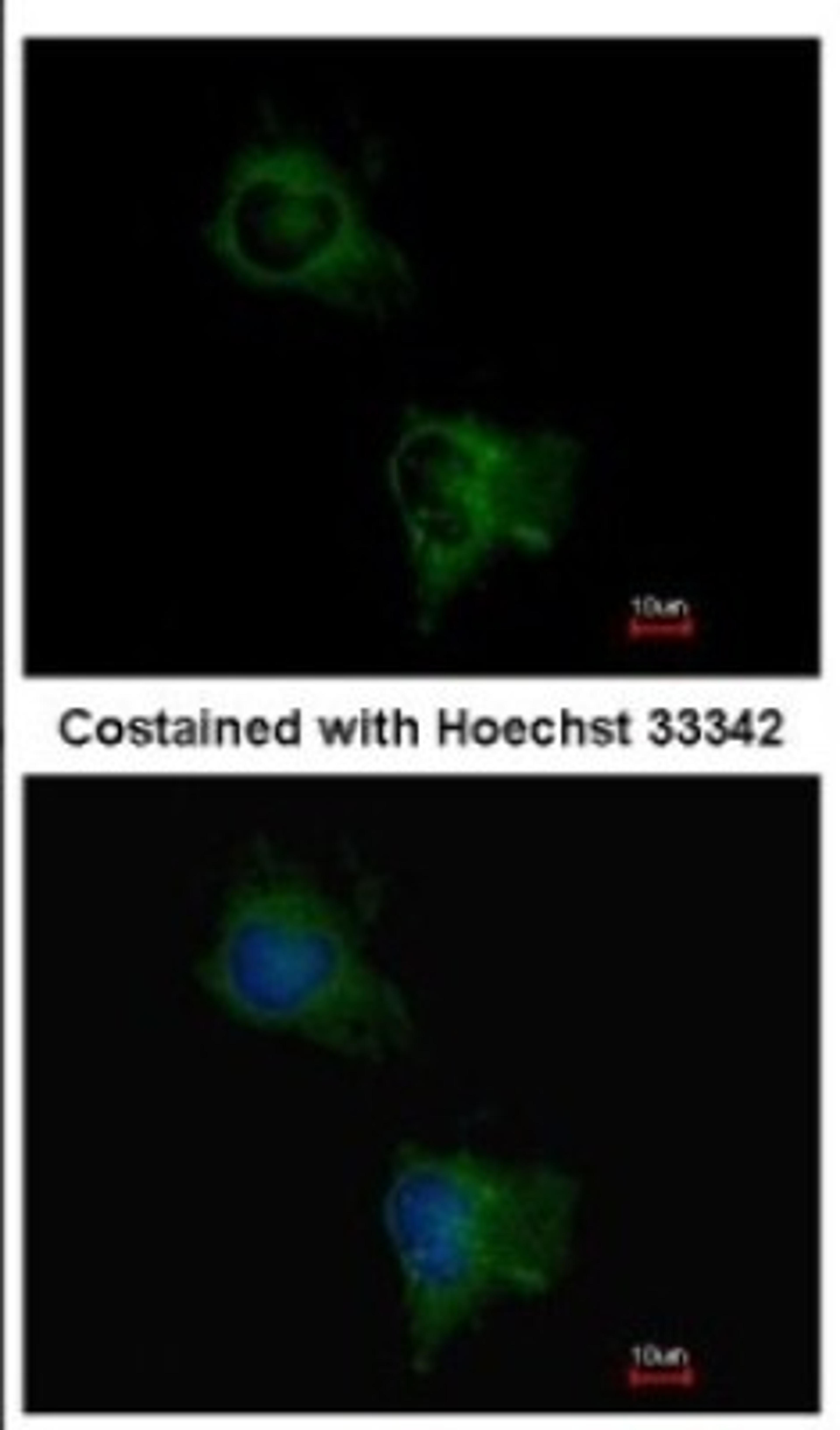 Immunocytochemistry/Immunofluorescence: TAS1R1 Antibody [NBP2-20571] - Immunofluorescence analysis of methanol-fixed HeLa, using antibody at 1:200 dilution.