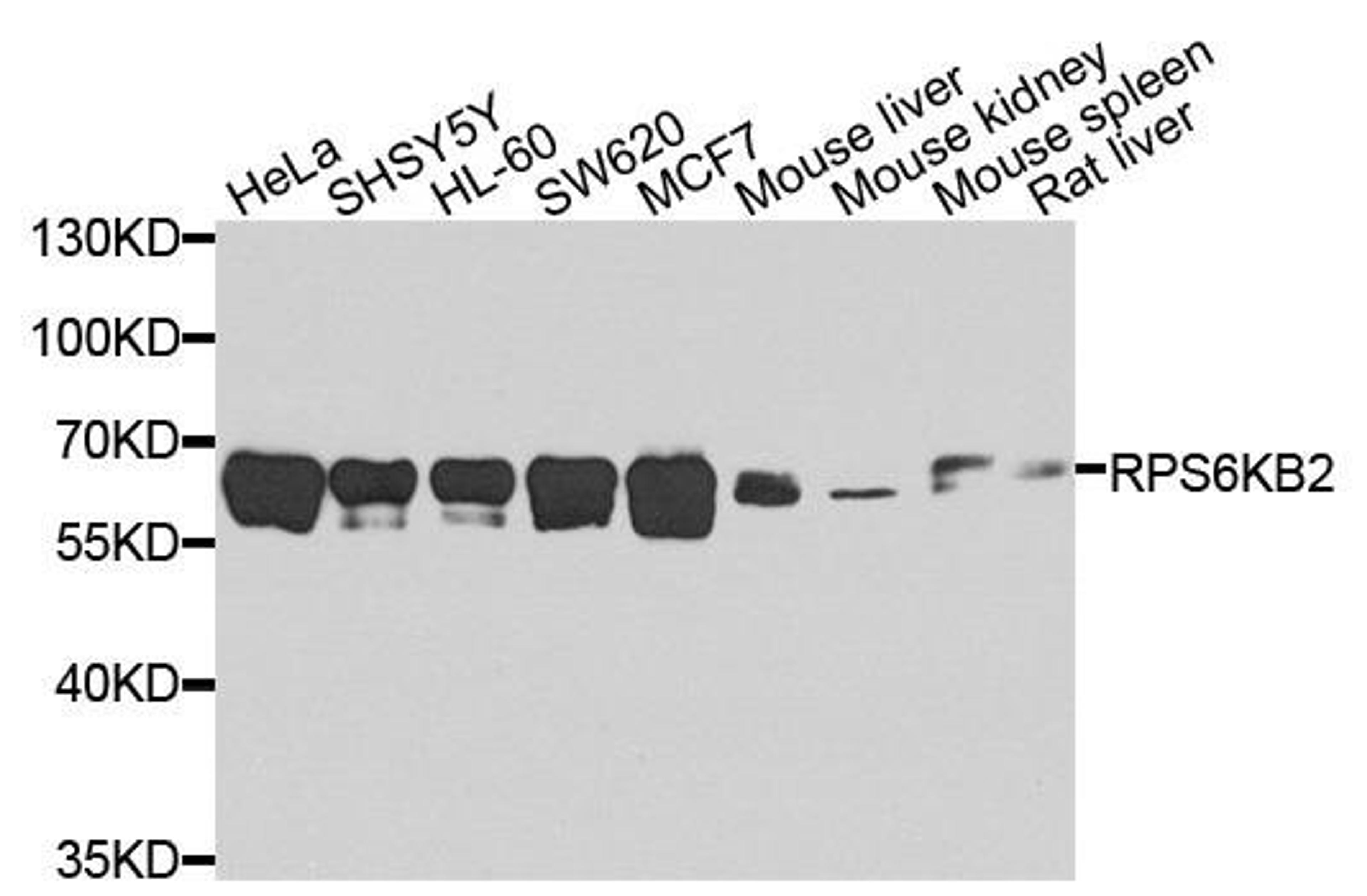 Western blot analysis of extracts of various cells using p70S6Kb antibody