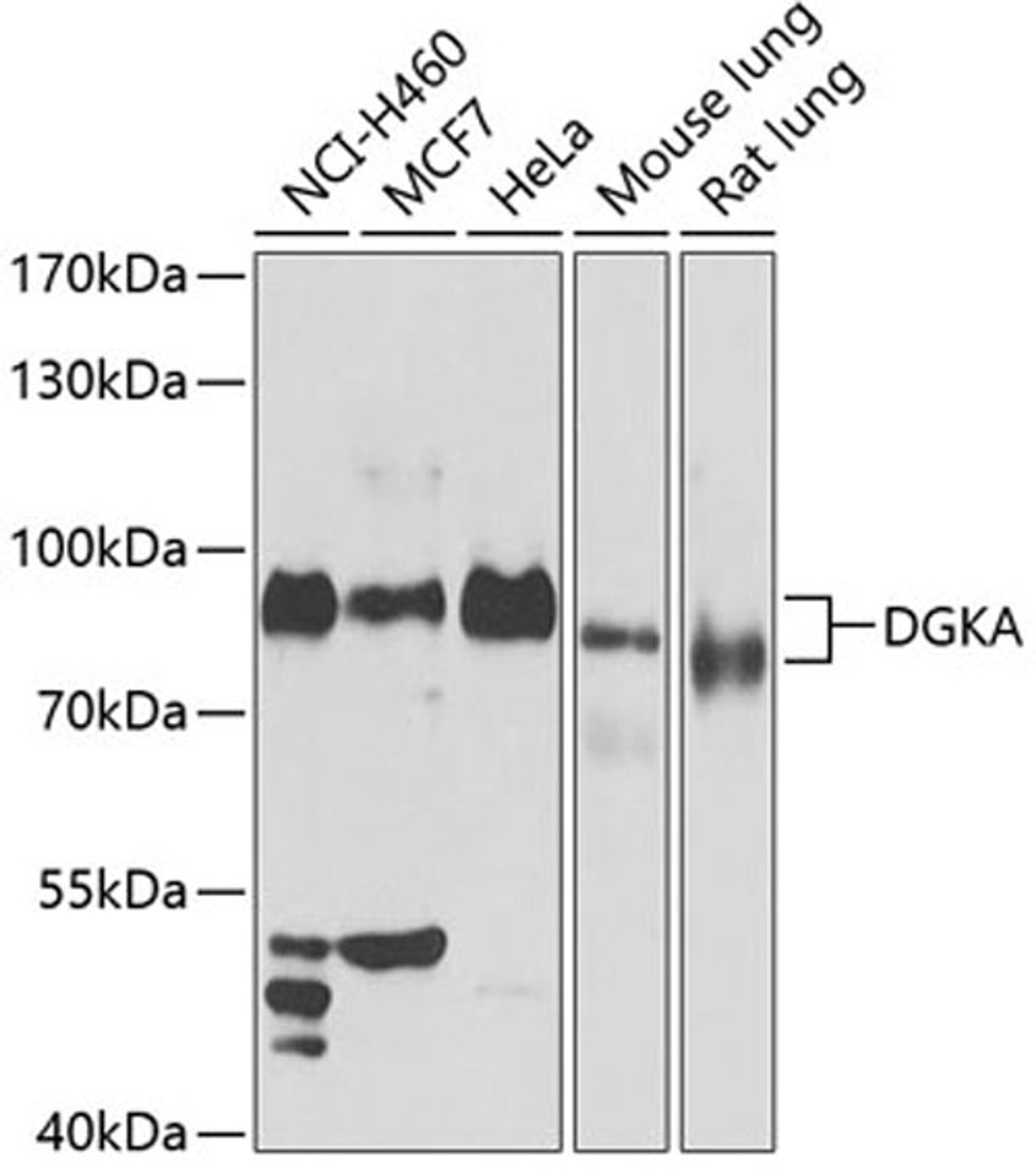 Western blot - DGKA antibody (A13969)