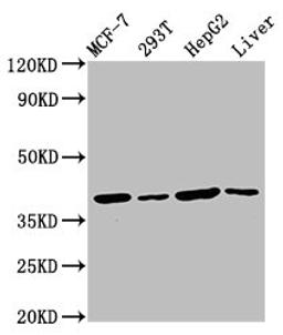Western Blot. Positive WB detected in: MCF-7 whole cell lysate, 293T whole cell lysate, HepG2 whole cell lysate, Mouse liver tissue. All lanes: IBA57 antibody at 4.5µg/ml. Secondary. Goat polyclonal to rabbit IgG at 1/50000 dilution. Predicted band size: 39 kDa. Observed band size: 39 kDa