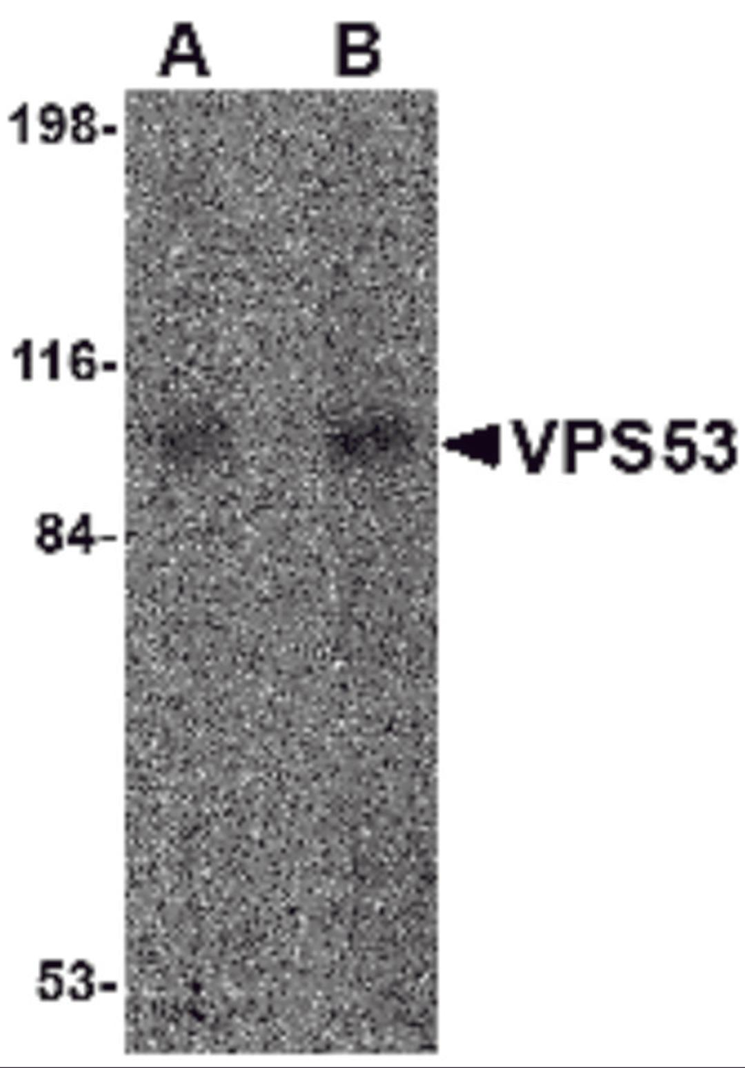 Western blot analysis of VPS53 in 293 cell lysate with VPS53 antibody at (A) 0.5 and (B) 1 &#956;g/mL.