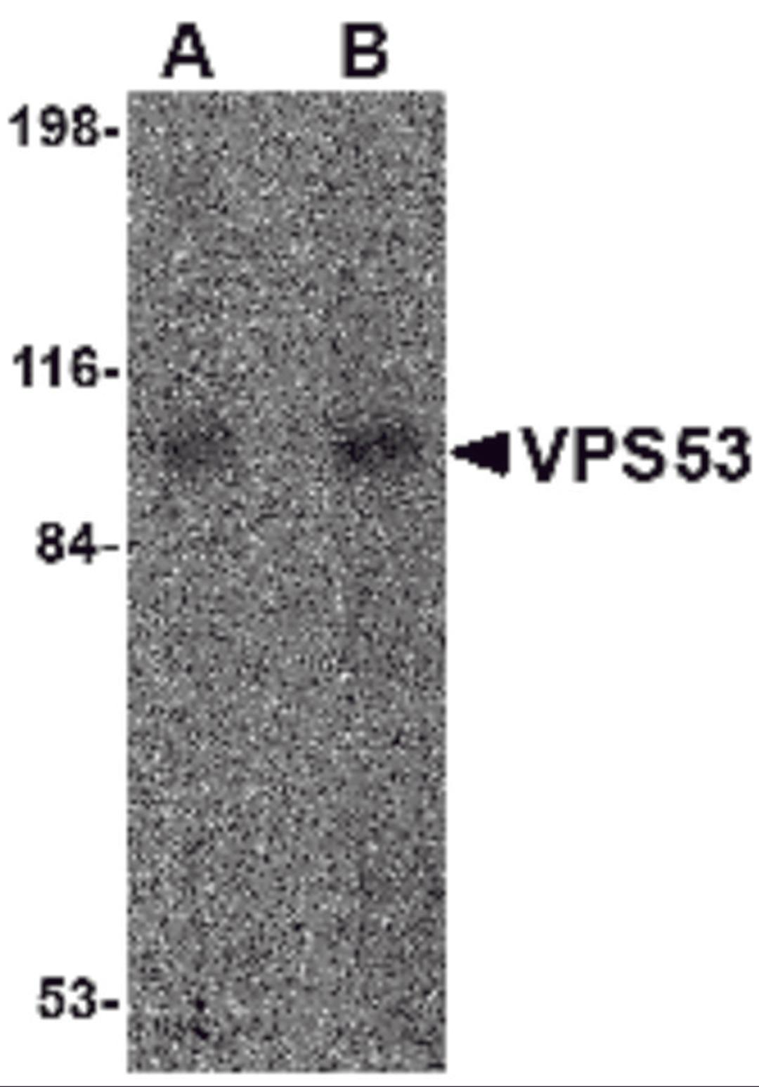 Western blot analysis of VPS53 in 293 cell lysate with VPS53 antibody at (A) 0.5 and (B) 1 μg/mL.