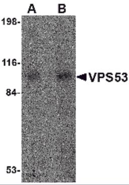 Western blot analysis of VPS53 in 293 cell lysate with VPS53 antibody at (A) 0.5 and (B) 1 μg/mL.