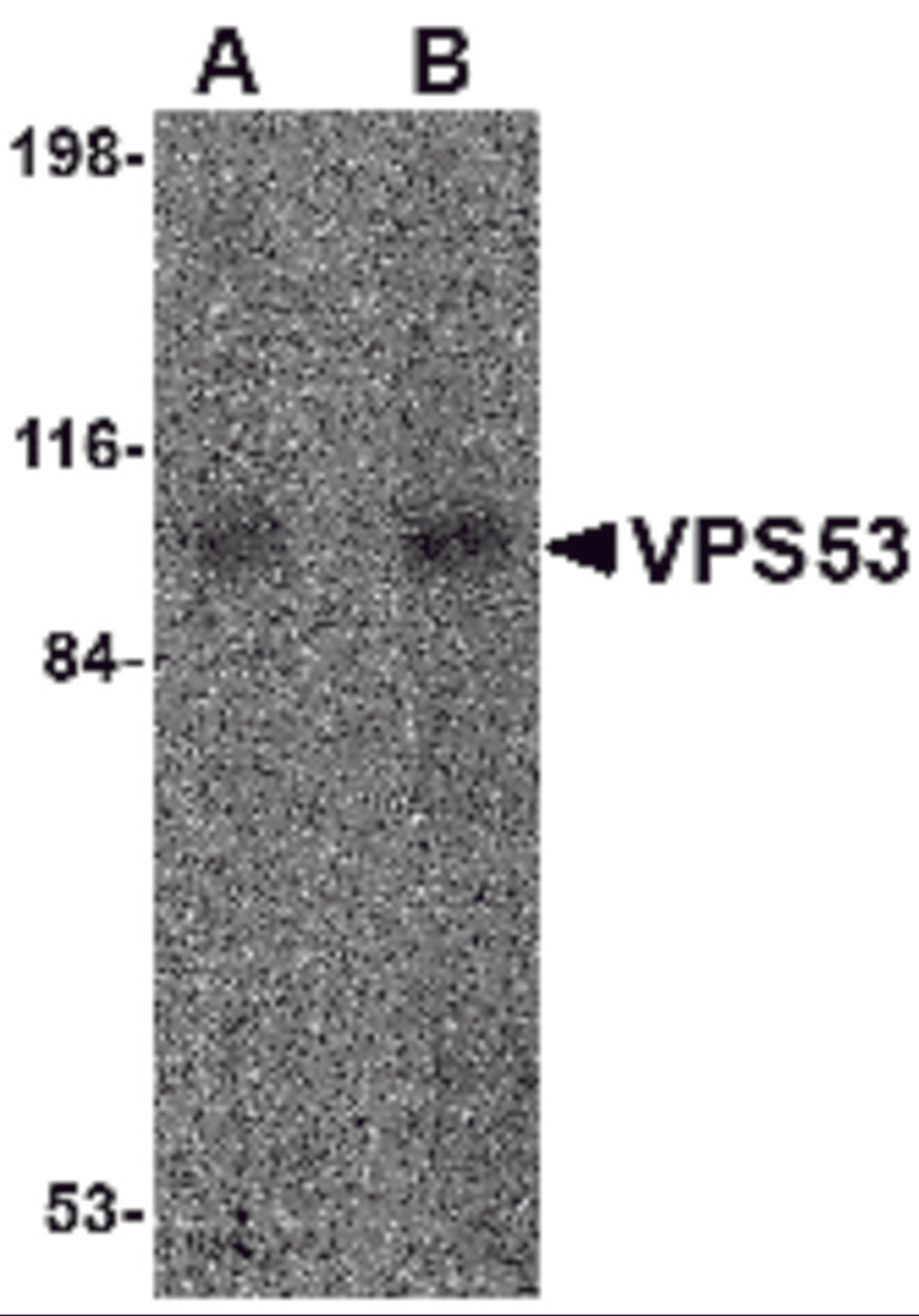 Western blot analysis of VPS53 in 293 cell lysate with VPS53 antibody at (A) 0.5 and (B) 1 μg/mL.