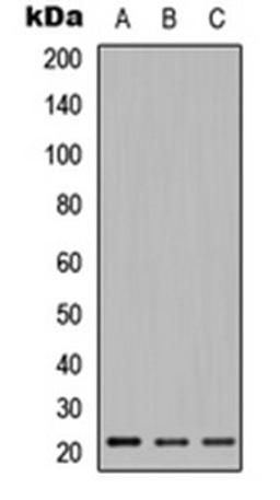 Western blot analysis of Jurkat (Lane 1), Raw264.7 (Lane 2), PC12 (Lane 3) whole cell lysates using Relaxin 2 antibody