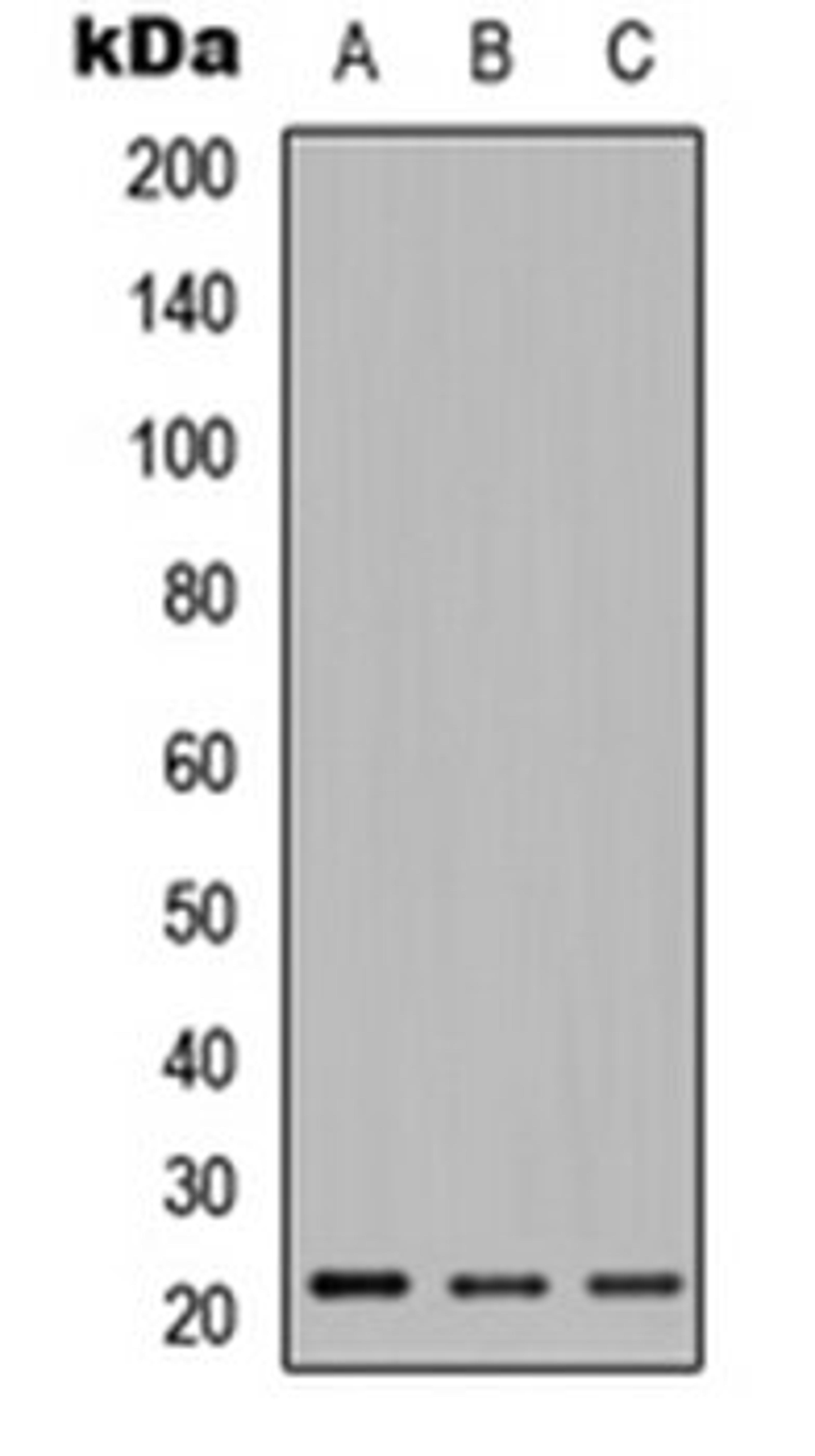 Western blot analysis of Jurkat (Lane 1), Raw264.7 (Lane 2), PC12 (Lane 3) whole cell lysates using Relaxin 2 antibody