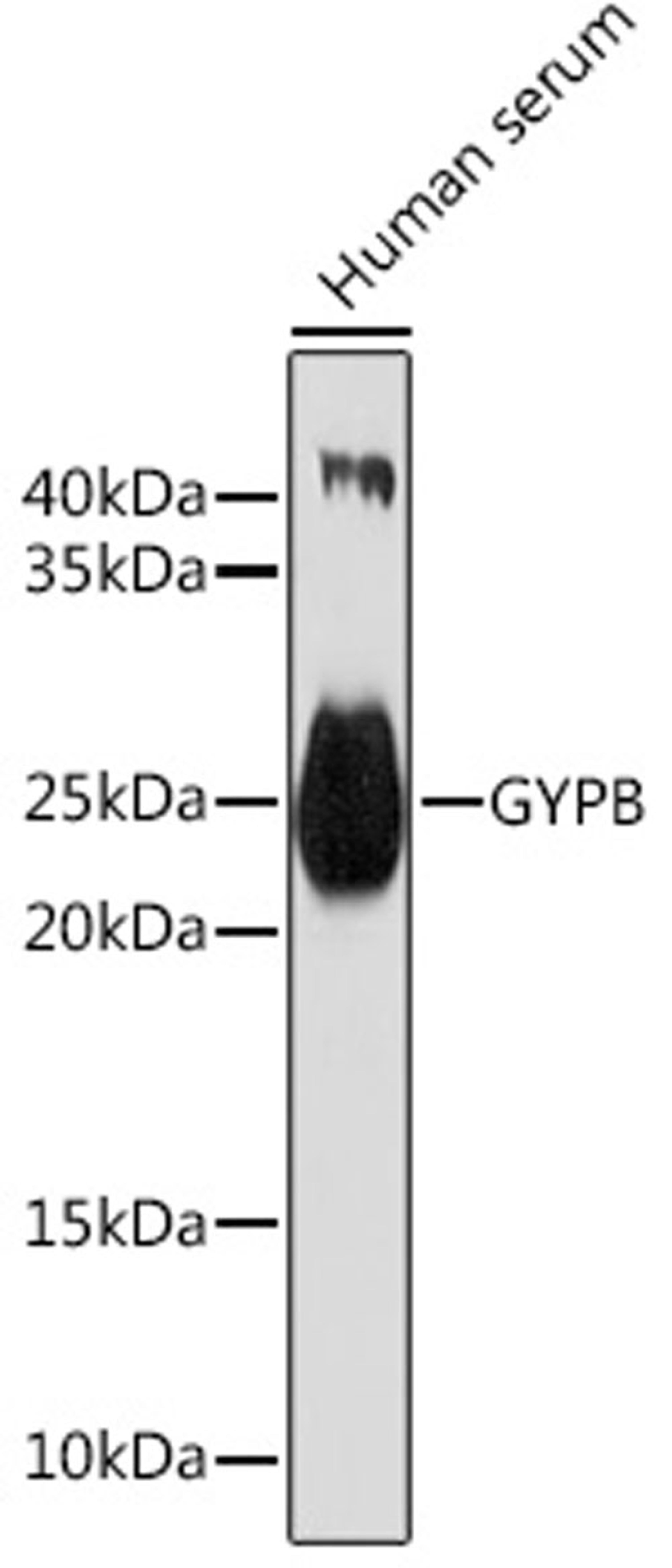 Western blot - GYPB Rabbit pAb (A7682)