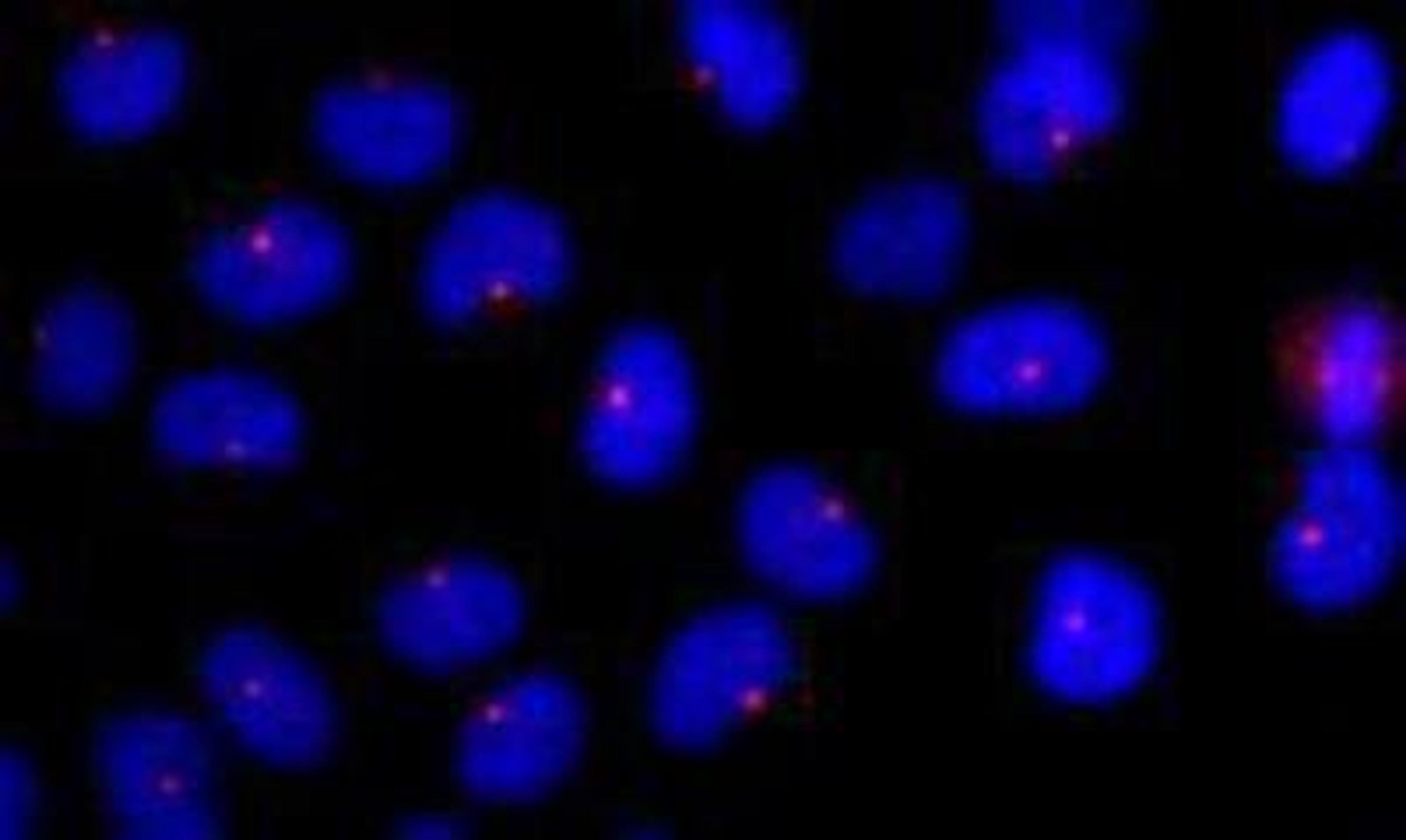 Immunocytochemistry/Immunofluorescence: CEP290 Antibody [NB100-86991] - NBF-fixed asynchronous HeLa cells. Permeabilization with Triton-X 100 is recommended.  Acetone fixation is not recommended.