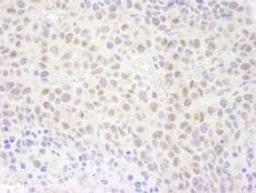 Detection of mouse RPA70 by immunohistochemistry.