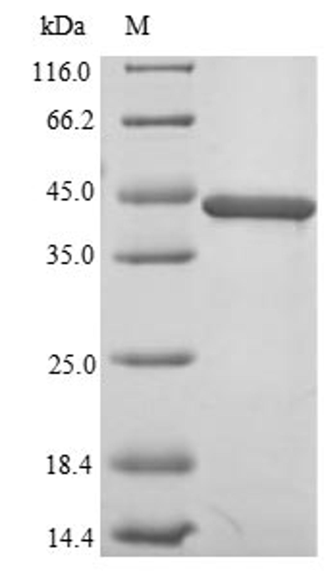 (Tris-Glycine gel) Discontinuous SDS-PAGE (reduced) with 5% enrichment gel and 15% separation gel.