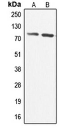 Western blot analysis of HeLa (Lane 1), U251MG (Lane 2) whole cell lysates using ADCK3 antibody