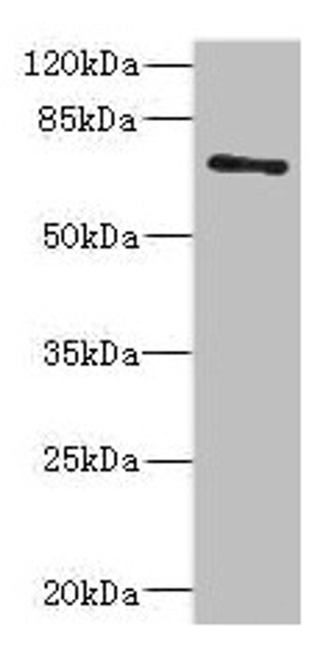 Western blot. All lanes: ZNF549 antibody at 1.09µg/ml + A549 whole cell lysate. Secondary. Goat polyclonal to rabbit IgG at 1/10000 dilution. Predicted band size: 75, 73 kDa. Observed band size: 75 kDa