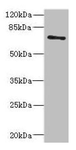 Western blot. All lanes: ZNF549 antibody at 1.09µg/ml + A549 whole cell lysate. Secondary. Goat polyclonal to rabbit IgG at 1/10000 dilution. Predicted band size: 75, 73 kDa. Observed band size: 75 kDa