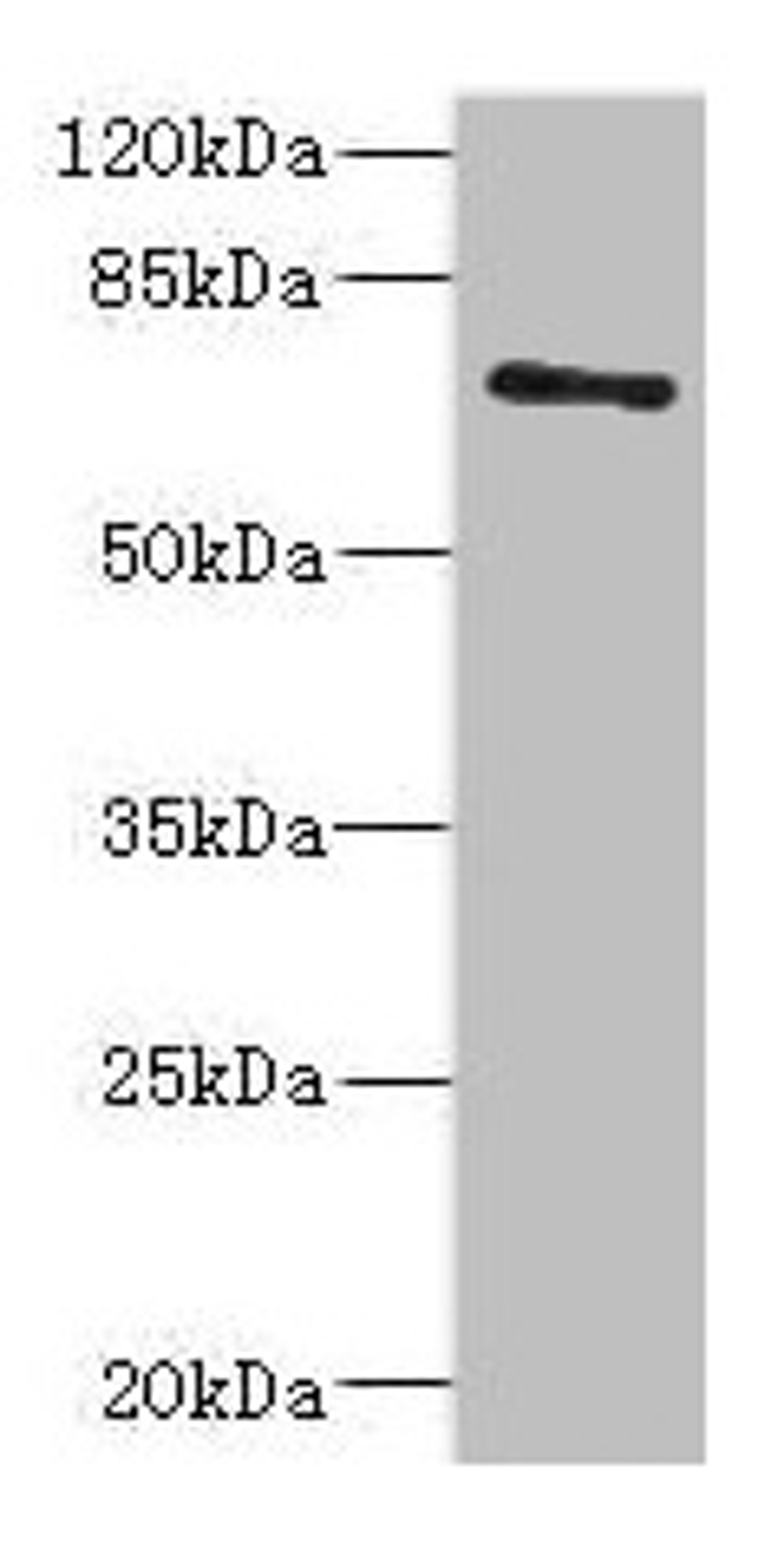 Western blot. All lanes: ZNF549 antibody at 1.09µg/ml + A549 whole cell lysate. Secondary. Goat polyclonal to rabbit IgG at 1/10000 dilution. Predicted band size: 75, 73 kDa. Observed band size: 75 kDa