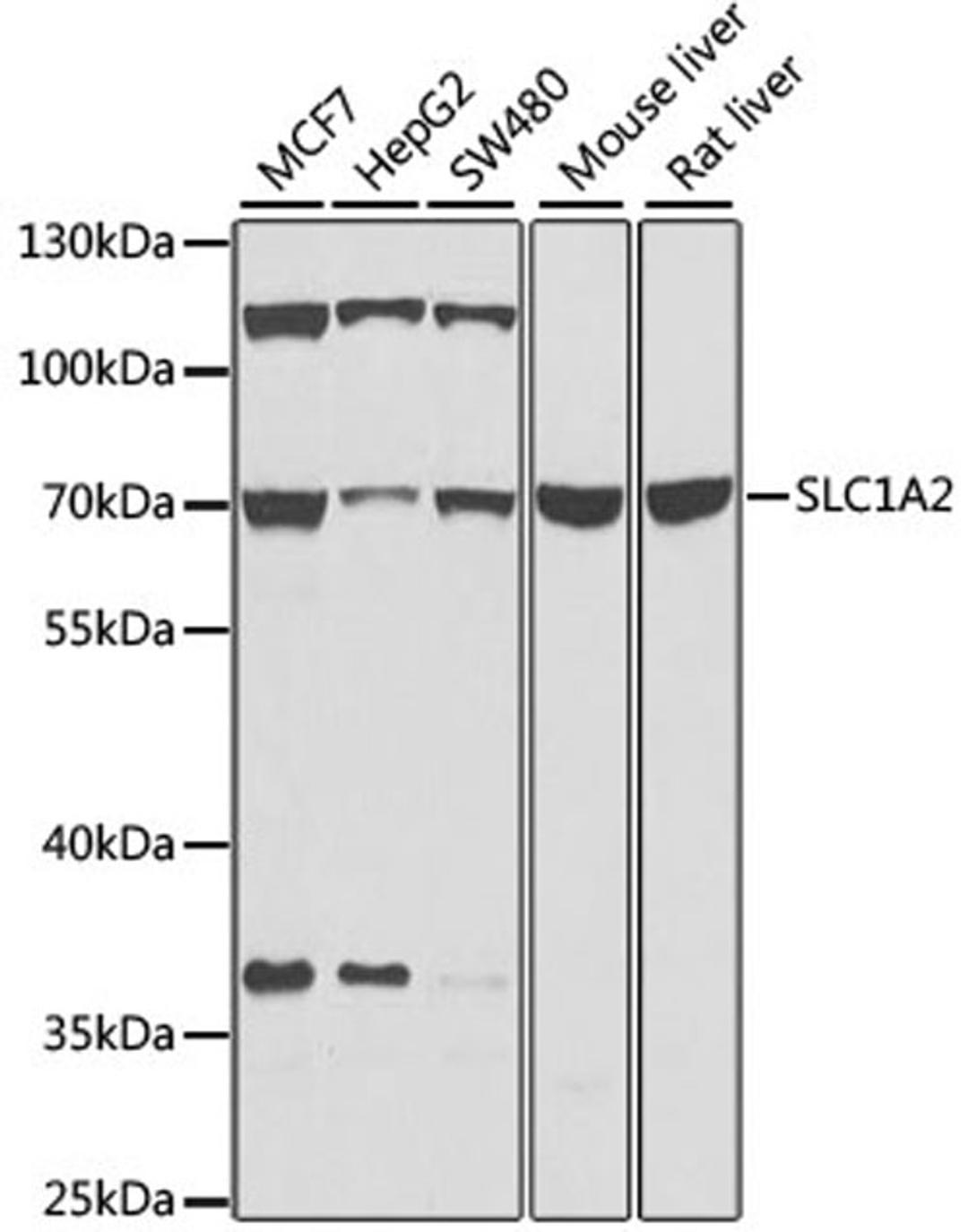 Western blot - SLC1A2 antibody (A0910)
