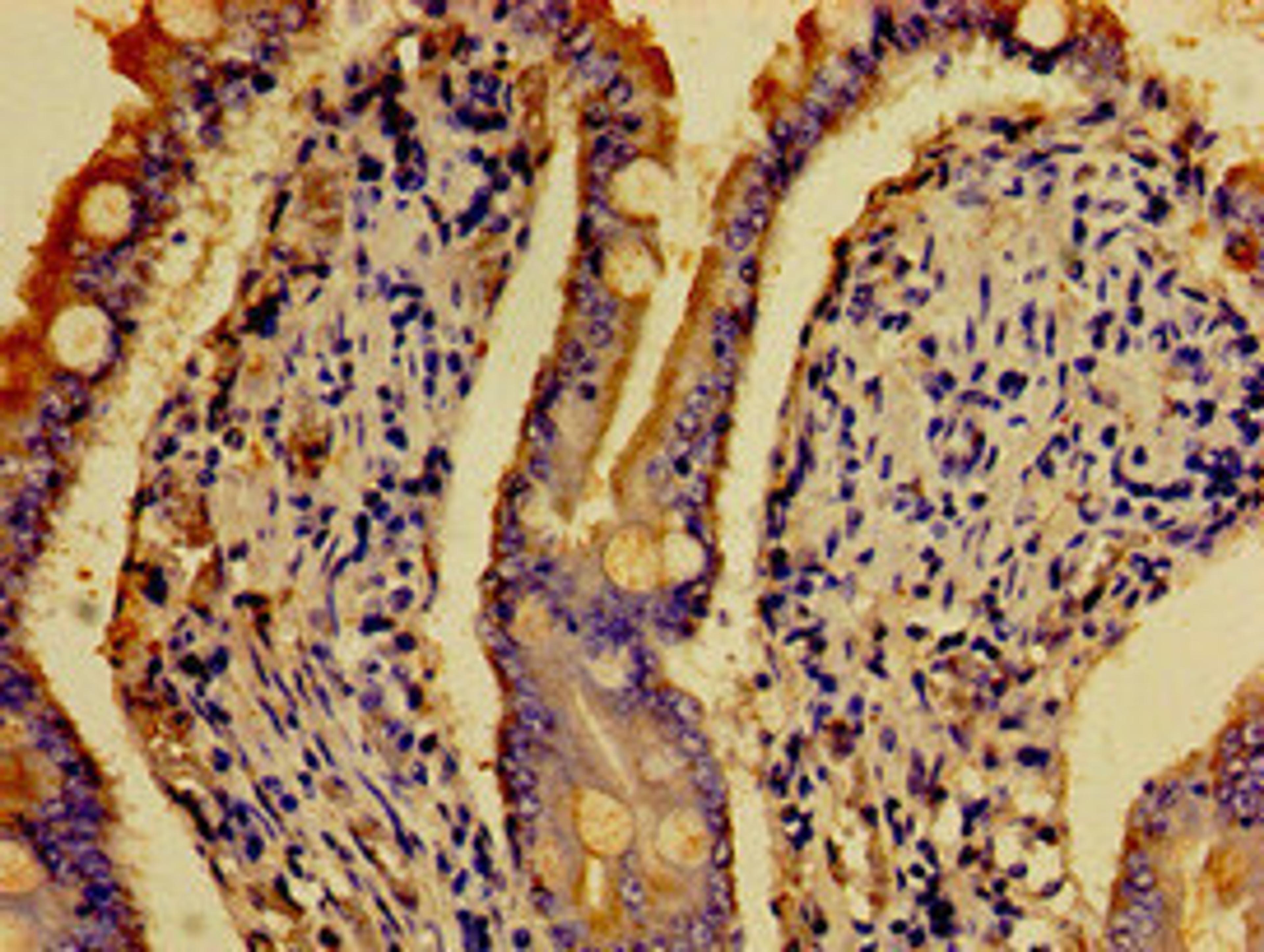 Immunohistochemistry of paraffin-embedded human small intestine tissue using CSB-PA010895LA01HU at dilution of 1:100