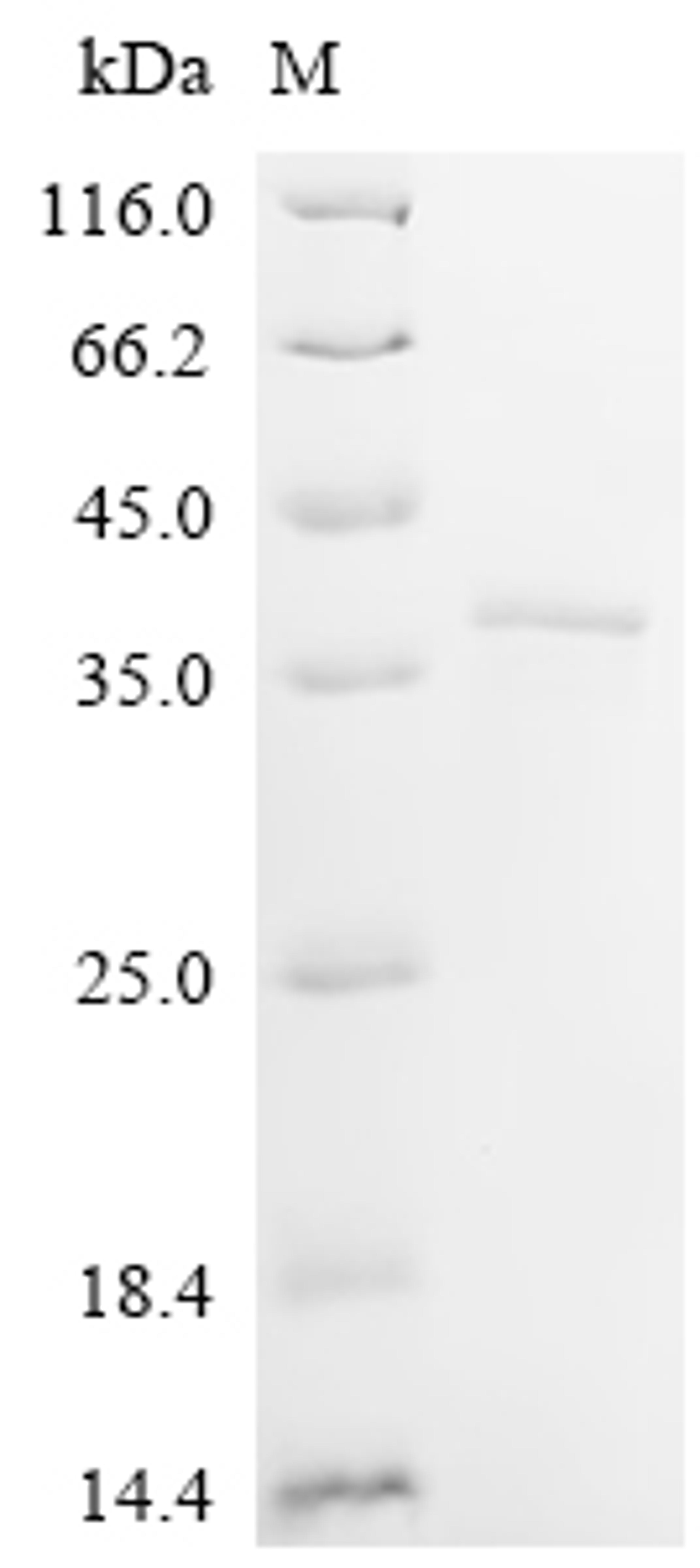 (Tris-Glycine gel) Discontinuous SDS-PAGE (reduced) with 5% enrichment gel and 15% separation gel.