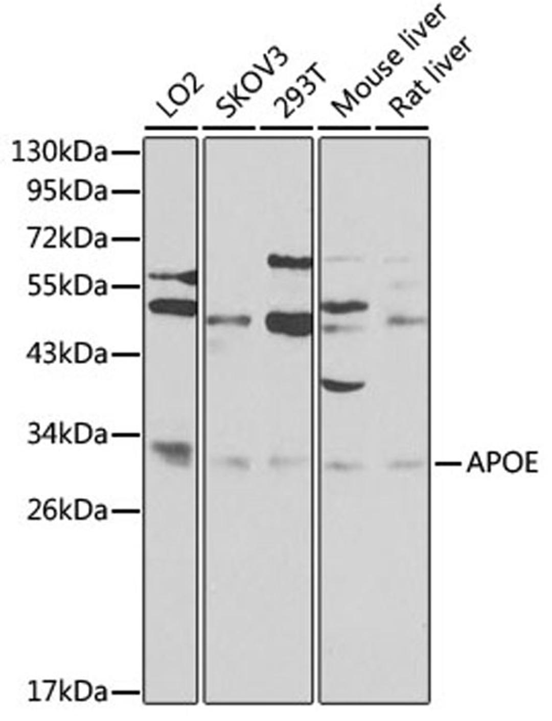 Western blot - ApoE antibody (A0304)