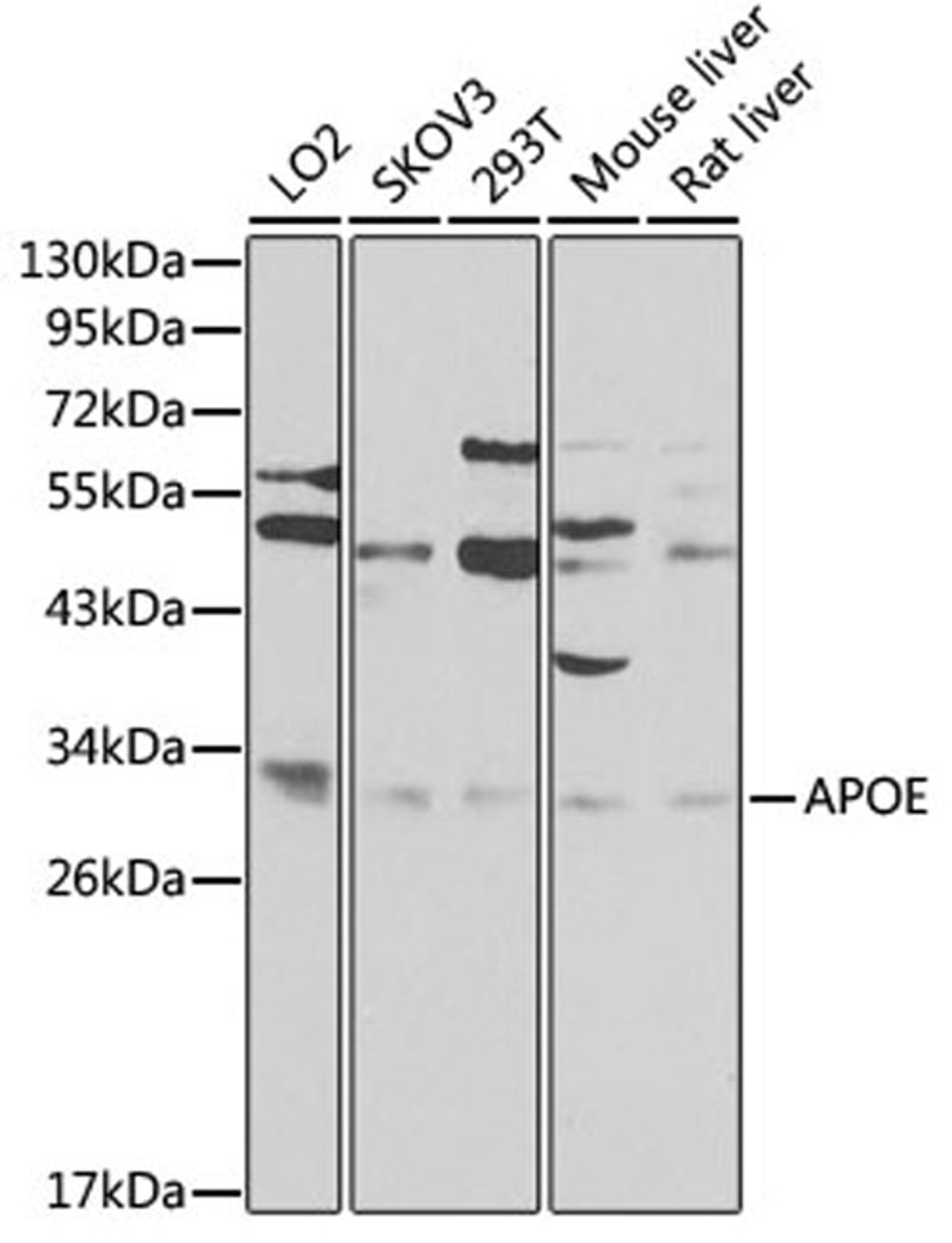 Western blot - ApoE antibody (A0304)