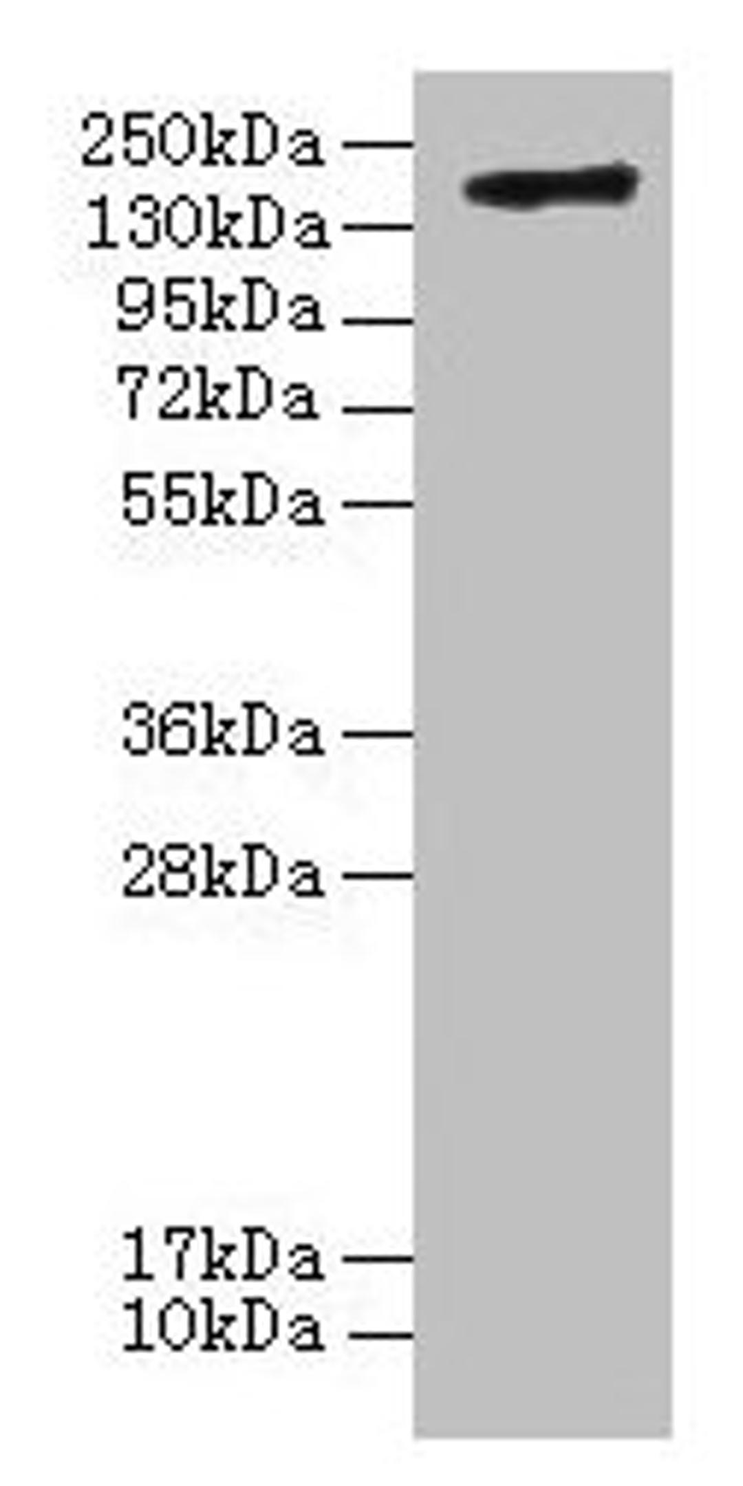 Western blot. All lanes: C3 antibody at 20µg/ml + Human high value serum. Secondary. Goat polyclonal to rabbit IgG at 1/10000 dilution. Predicted band size: 187, 61 kDa. Observed band size: 187 kDa