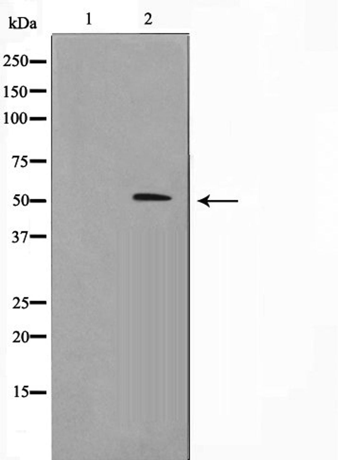 Western blot analysis of HT29 cell lysate using 2J2 (Cytochrome P450) antibody