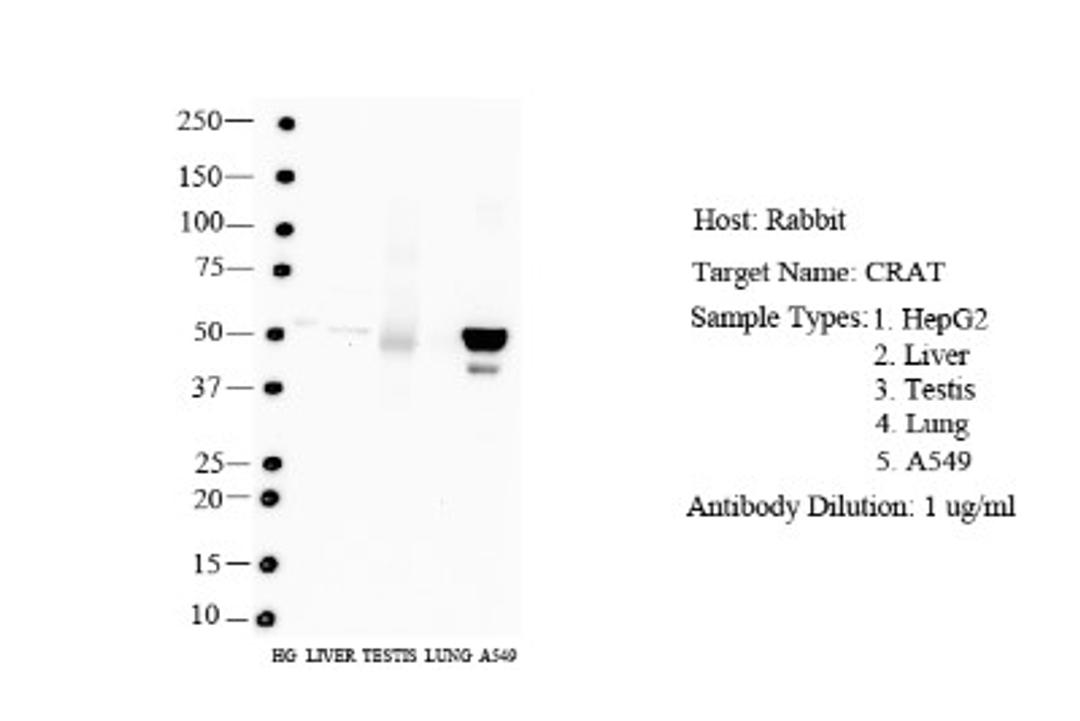 Western Blot: CRAT Antibody [NBP1-79532] - Human HepG2, Liver, Testis Antibody Dilution: 2.0 ug/ml.