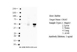 Western Blot: CRAT Antibody [NBP1-79532] - Human HepG2, Liver, Testis Antibody Dilution: 2.0 ug/ml.