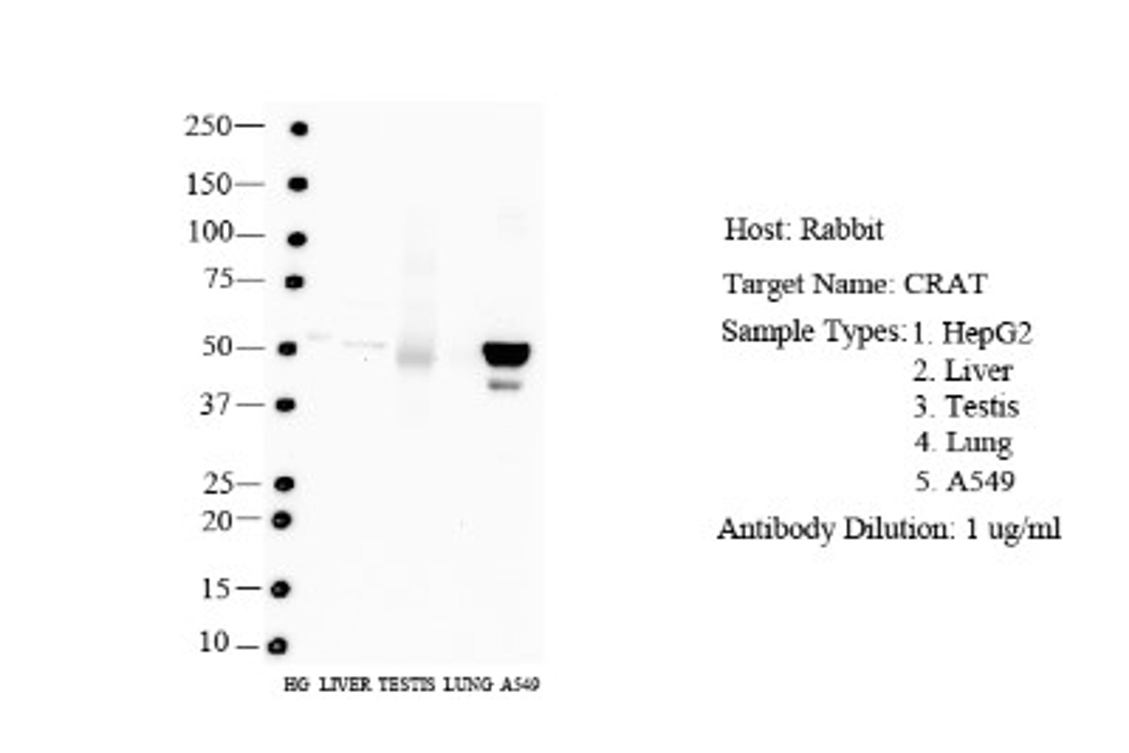 Western Blot: CRAT Antibody [NBP1-79532] - Human HepG2, Liver, Testis Antibody Dilution: 2.0 ug/ml.