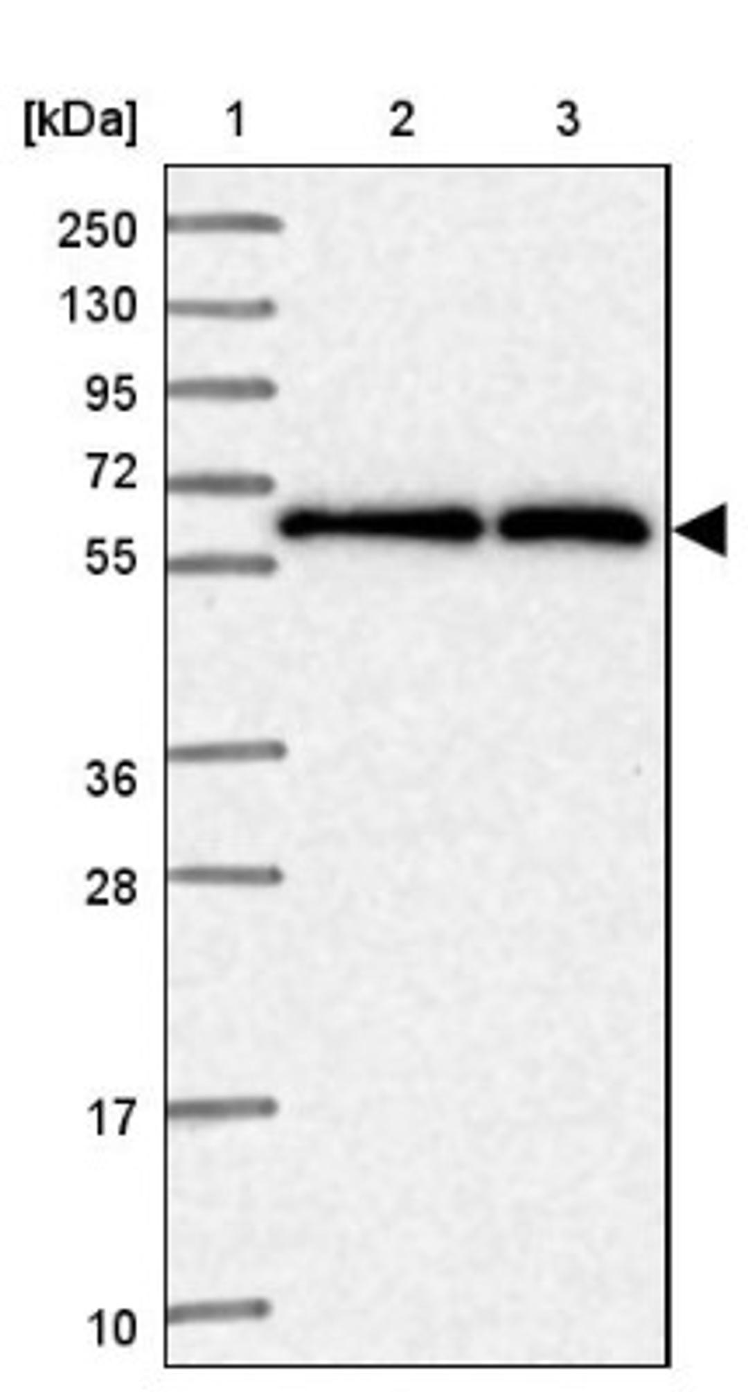 Western Blot: CCT6B Antibody [NBP2-33583] - Lane 1: Marker [kDa] 250, 130, 95, 72, 55, 36, 28, 17, 10<br/>Lane 2: Human cell line RT-4<br/>Lane 3: Human cell line U-251MG sp